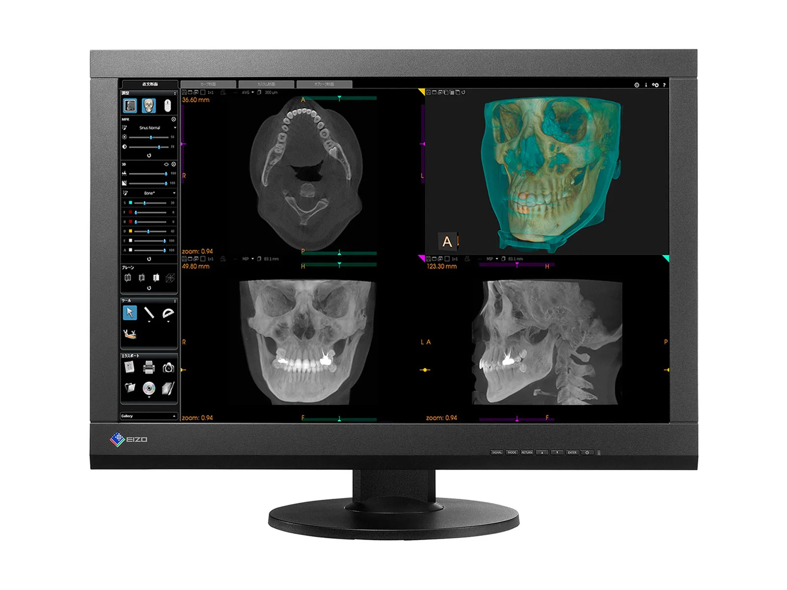 Eizo RadiForce MX242W 2.3MP 24" Color Clinical Review Display (MX242W-BK)