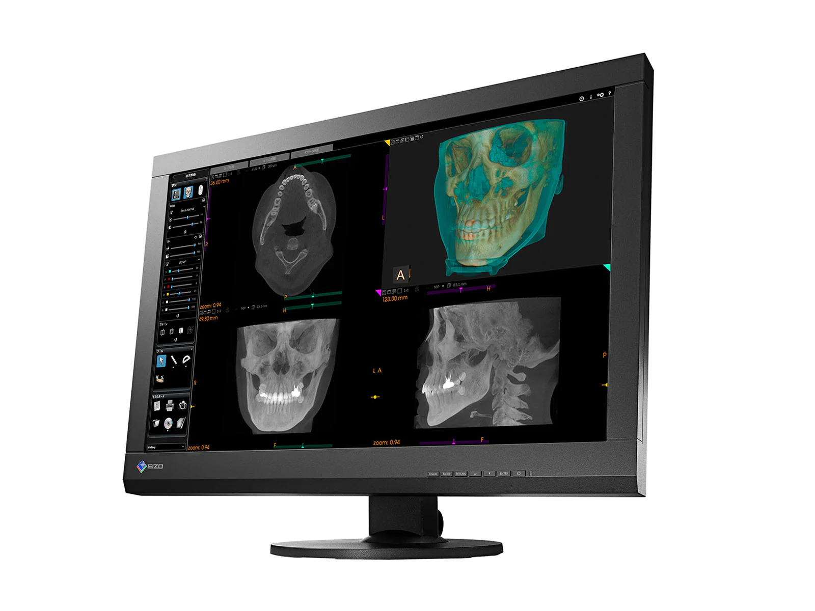 Eizo RadiForce MX242W 2.3MP 24" Color Clinical Review Display (MX242W-BK) 2 Eizo RadiForce MX242W 2.3MP 24" Color Clinical Review Display (MX242W-BK)