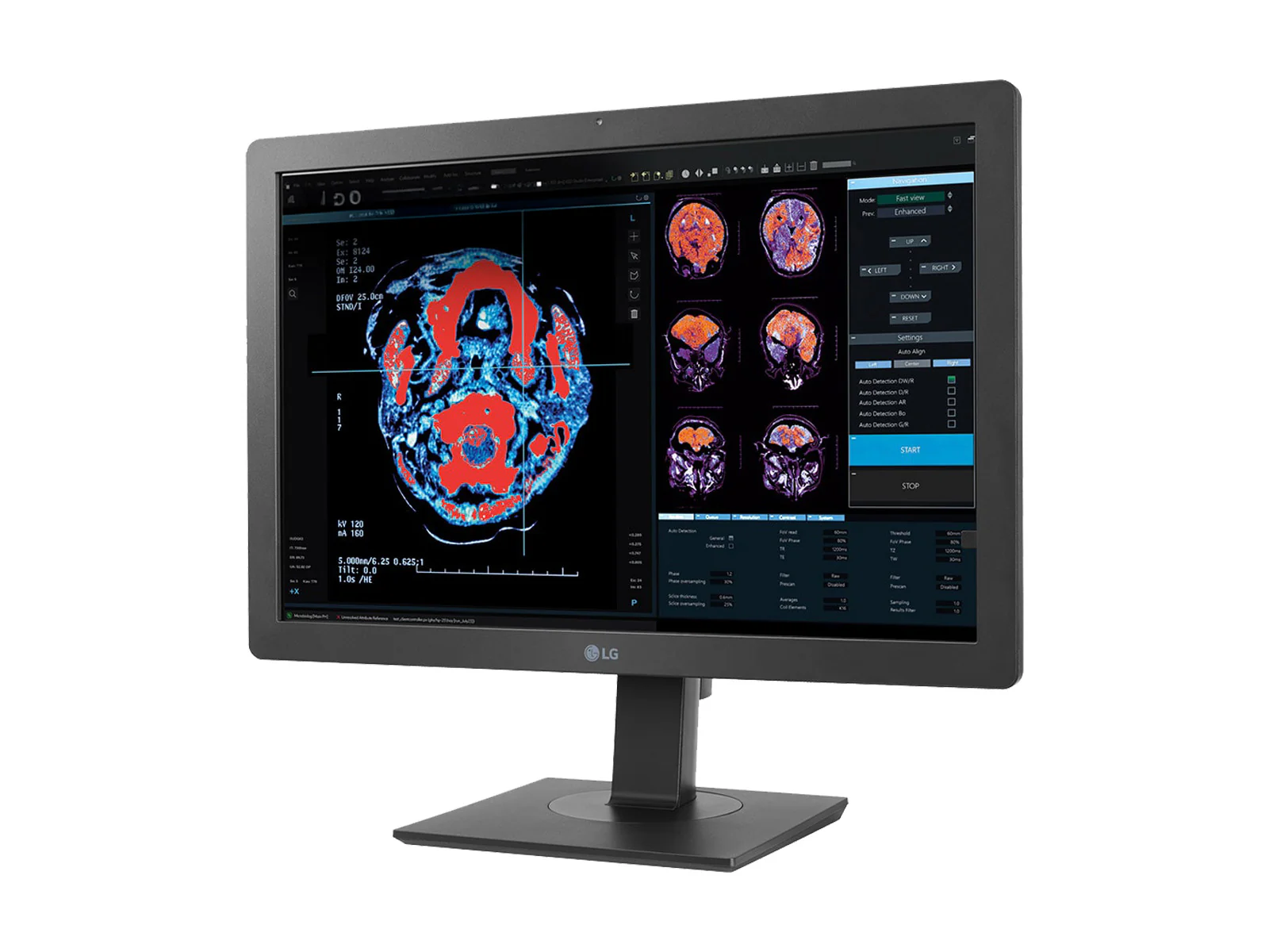 LG 2MP 24" 24HR513C-B Clinical Review Medical Display Monitor with Auto DICOM calibration 6 LG 2MP 24" 24HR513C-B Clinical Review Medical Display Monitor with Auto DICOM calibration