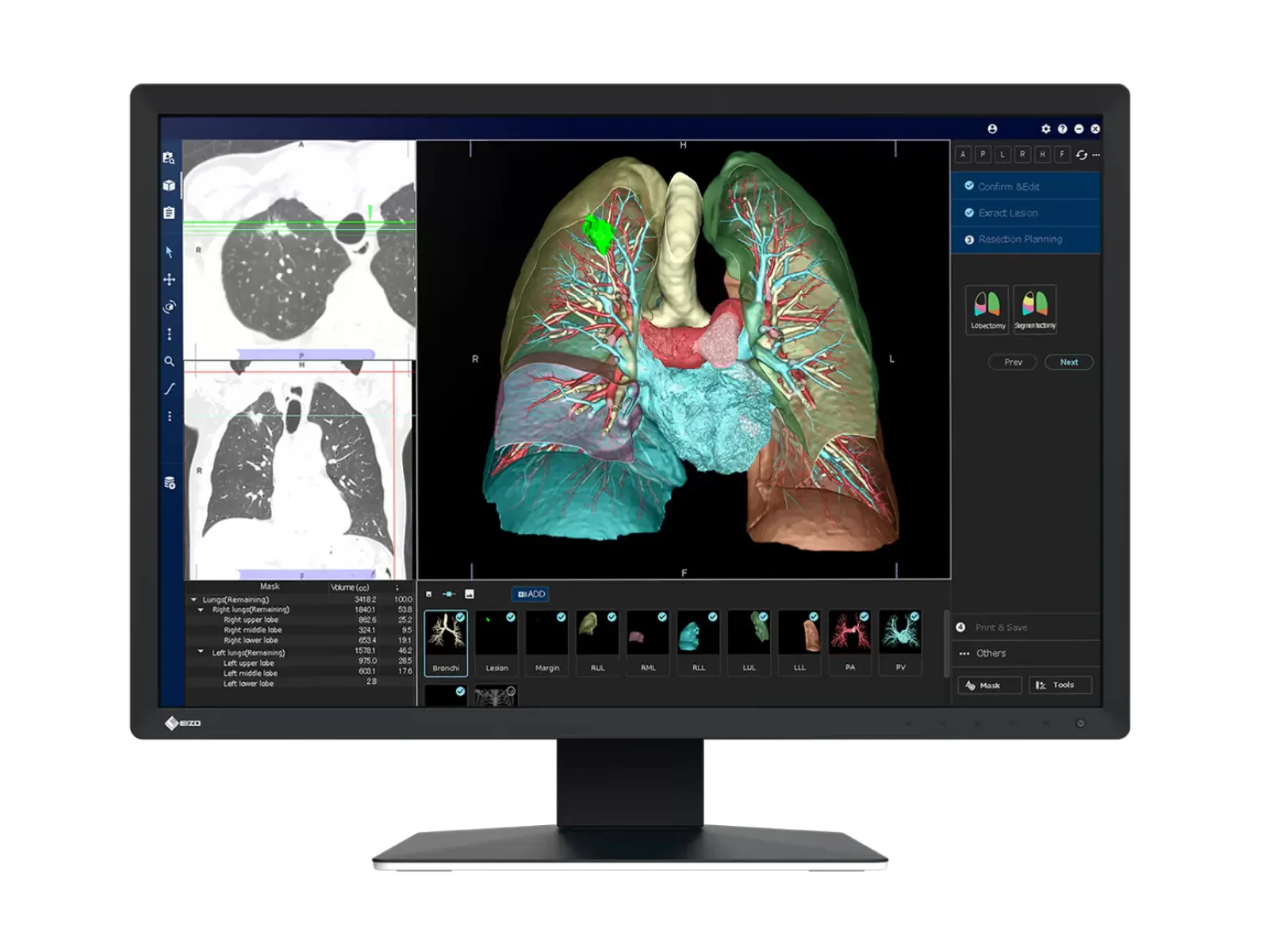 Eizo RadiForce MX243W 2.3MP 24" Color Clinical Review Display (MX243W)