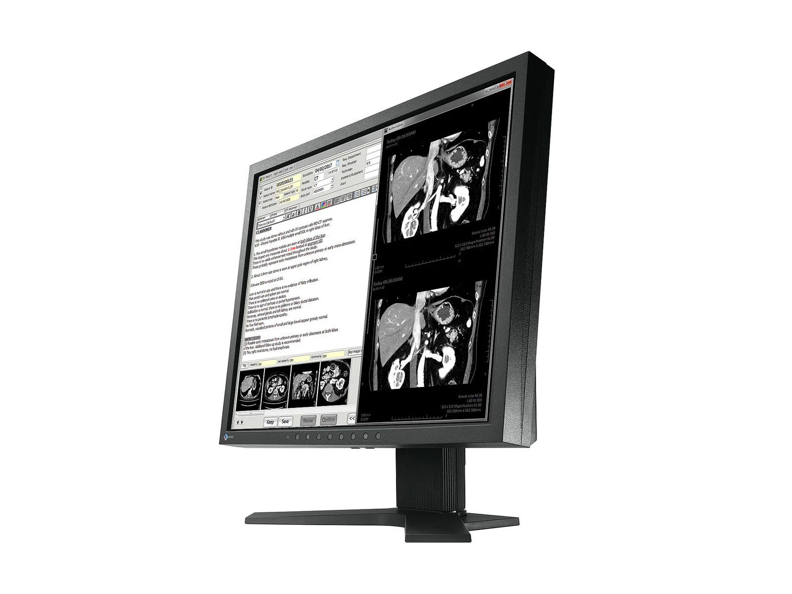 Eizo Radiforce MX194 1MP 19" Clinical Review Monitor (MX194) 2 Eizo Radiforce MX194 1MP 19" Clinical Review Monitor (MX194)