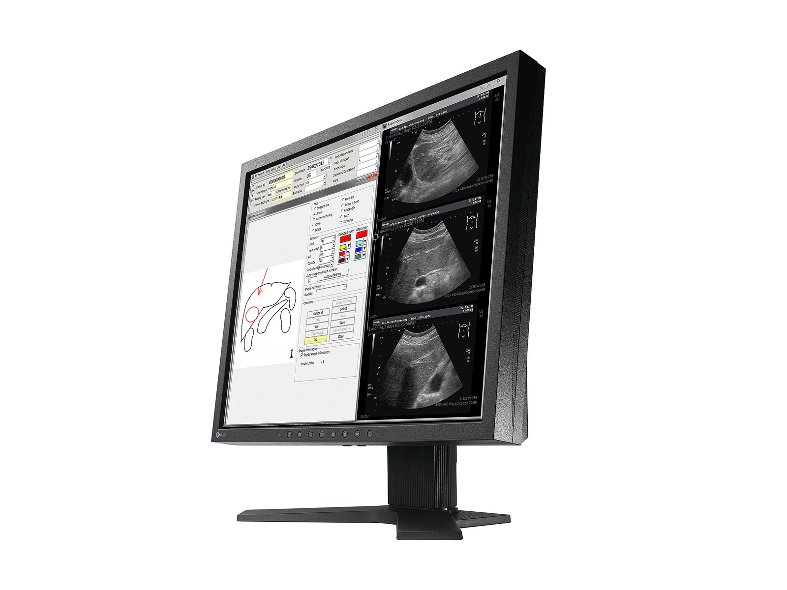 Eizo Radiforce MX194 1MP 19" Clinical Review Monitor (MX194) 3 Eizo Radiforce MX194 1MP 19" Clinical Review Monitor (MX194)