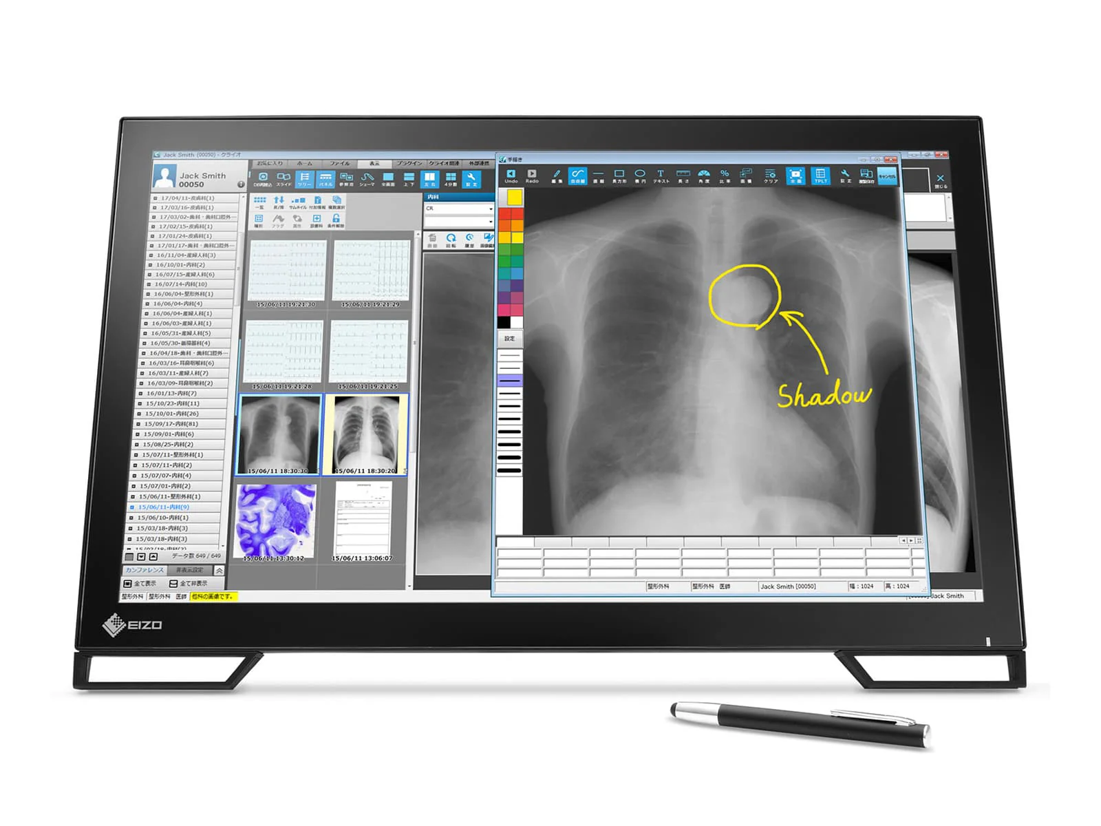 Eizo Radiforce MS236WT 2MP 23" Multi-Touch Color Clinical Review Dental Monitor with Stylus Pen (MS236WT)