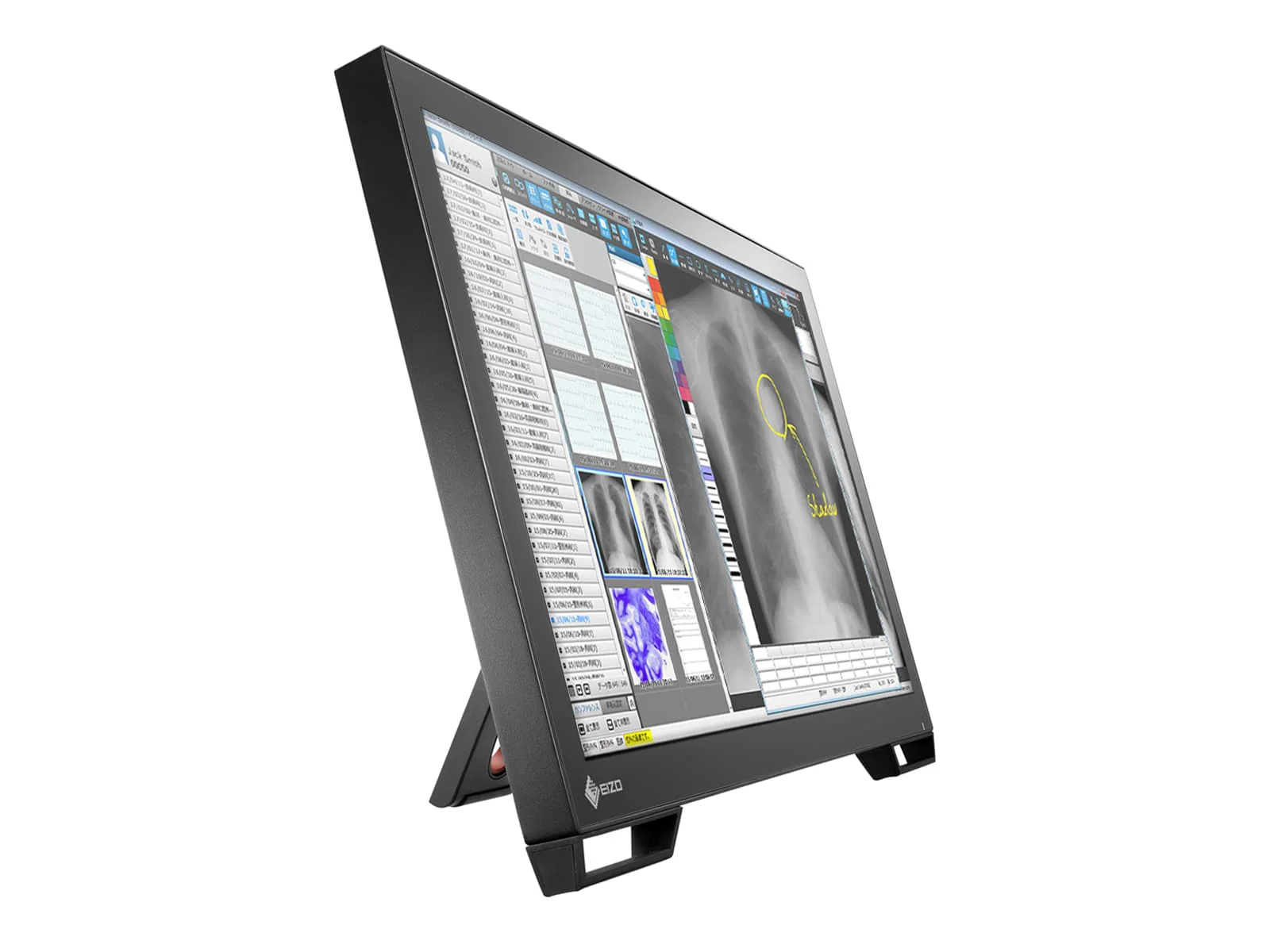 Eizo Radiforce MS236WT 2MP 23" Multi-Touch Color Clinical Review Dental Monitor with Stylus Pen (MS236WT) 2 Eizo Radiforce MS236WT 2MP 23" Multi-Touch Color Clinical Review Dental Monitor with Stylus Pen (MS236WT)