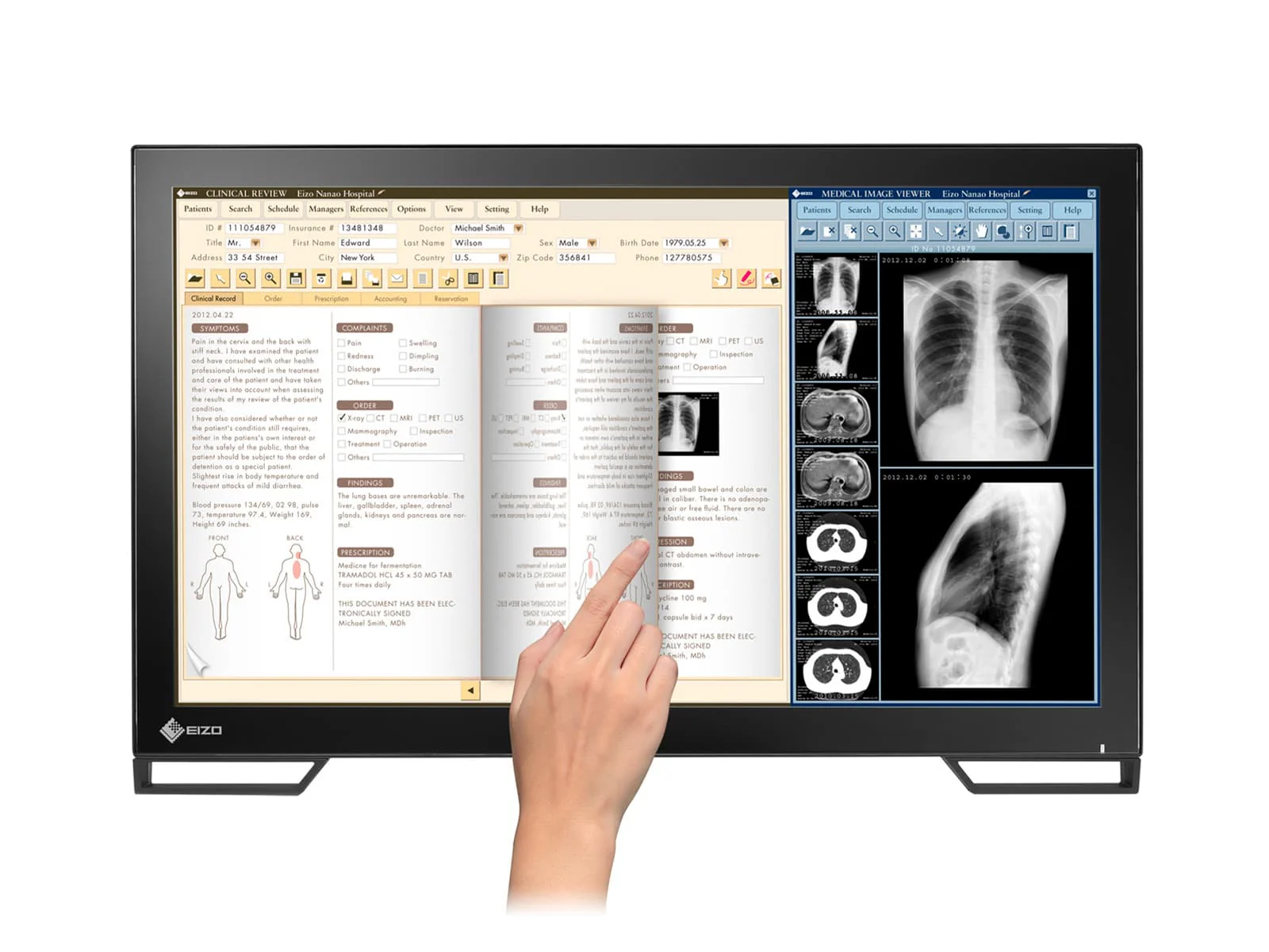 Eizo Radiforce MS236WT 2MP 23" Multi-Touch Color Clinical Review Dental Monitor with Stylus Pen (MS236WT) 6 Eizo Radiforce MS236WT 2MP 23" Multi-Touch Color Clinical Review Dental Monitor with Stylus Pen (MS236WT)