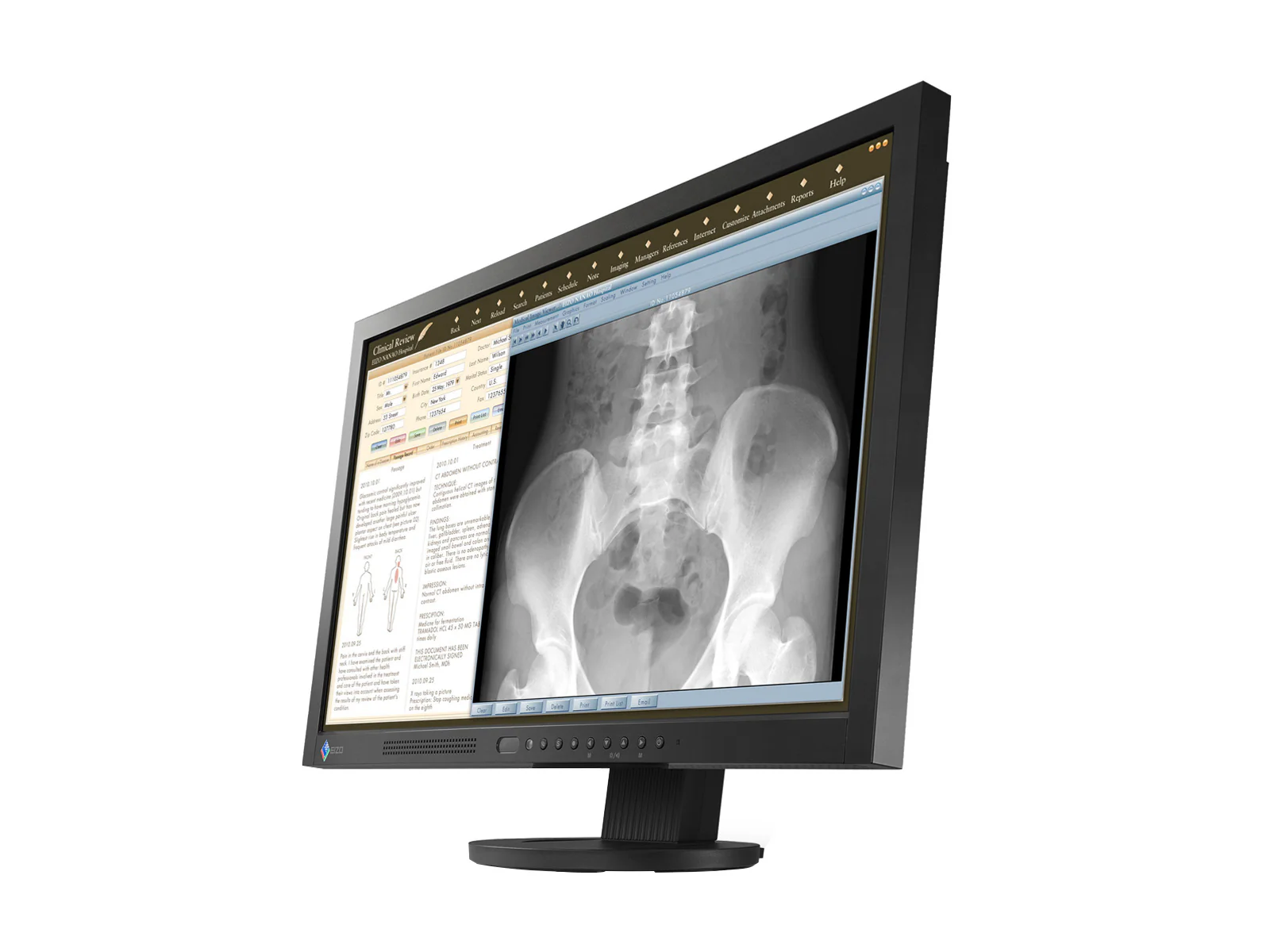 Eizo RadiForce MS230W 2MP 23" Color Clinical Review Medical Display Monitor (MS230WUKBKB) 2 Eizo RadiForce MS230W 2MP 23" Color Clinical Review Medical Display Monitor (MS230WUKBKB)