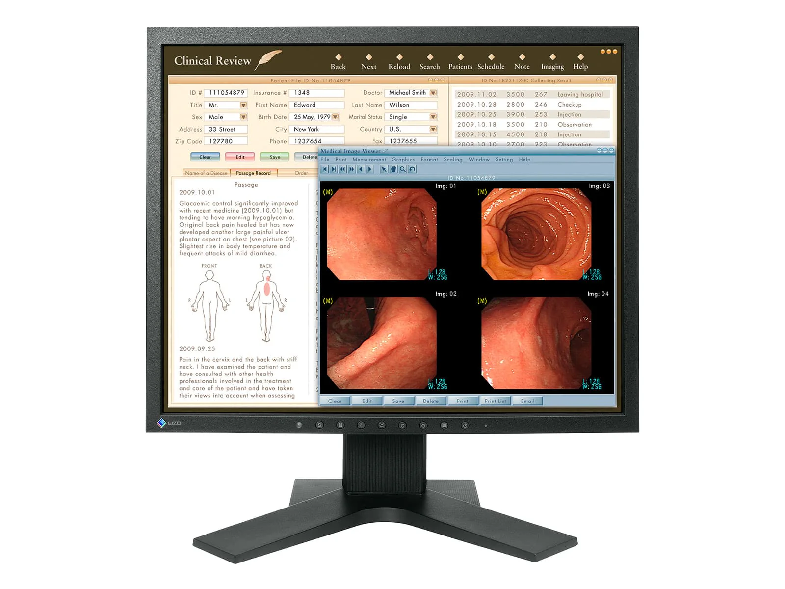 Eizo RadiForce MX191 1MP 19" Color Clinical Review Monitor (MX191)