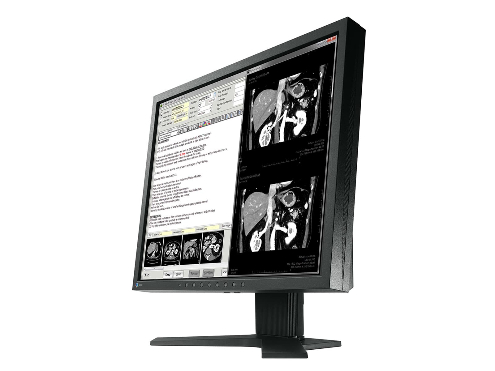 Eizo RadiForce MX191 1MP 19" Color Clinical Review Monitor (MX191) 2 Eizo RadiForce MX191 1MP 19" Color Clinical Review Monitor (MX191)