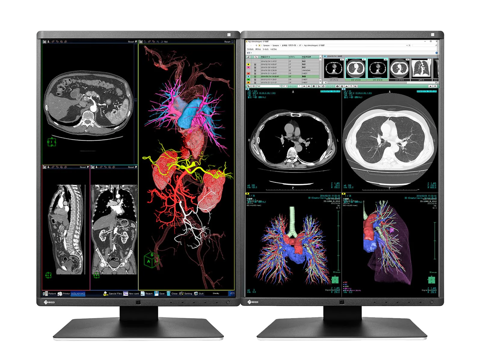 Eizo RadiForce RX360 3MP 21" Color General Radiology PACS Display Monitor (RX360)