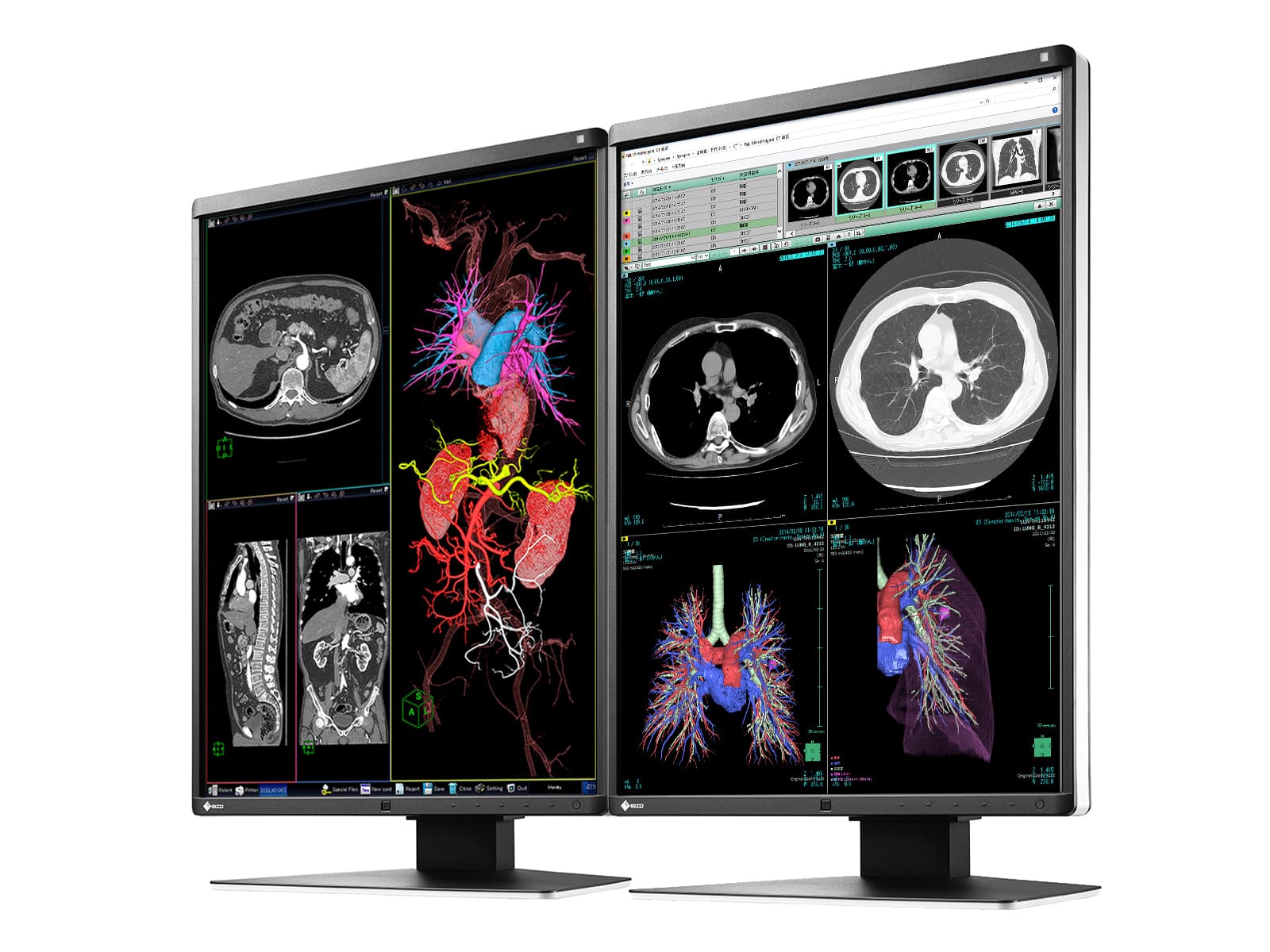 Eizo RadiForce RX360 3MP 21" Color General Radiology PACS Display Monitor (RX360) 2 Eizo RadiForce RX360 3MP 21" Color General Radiology PACS Display Monitor (RX360)