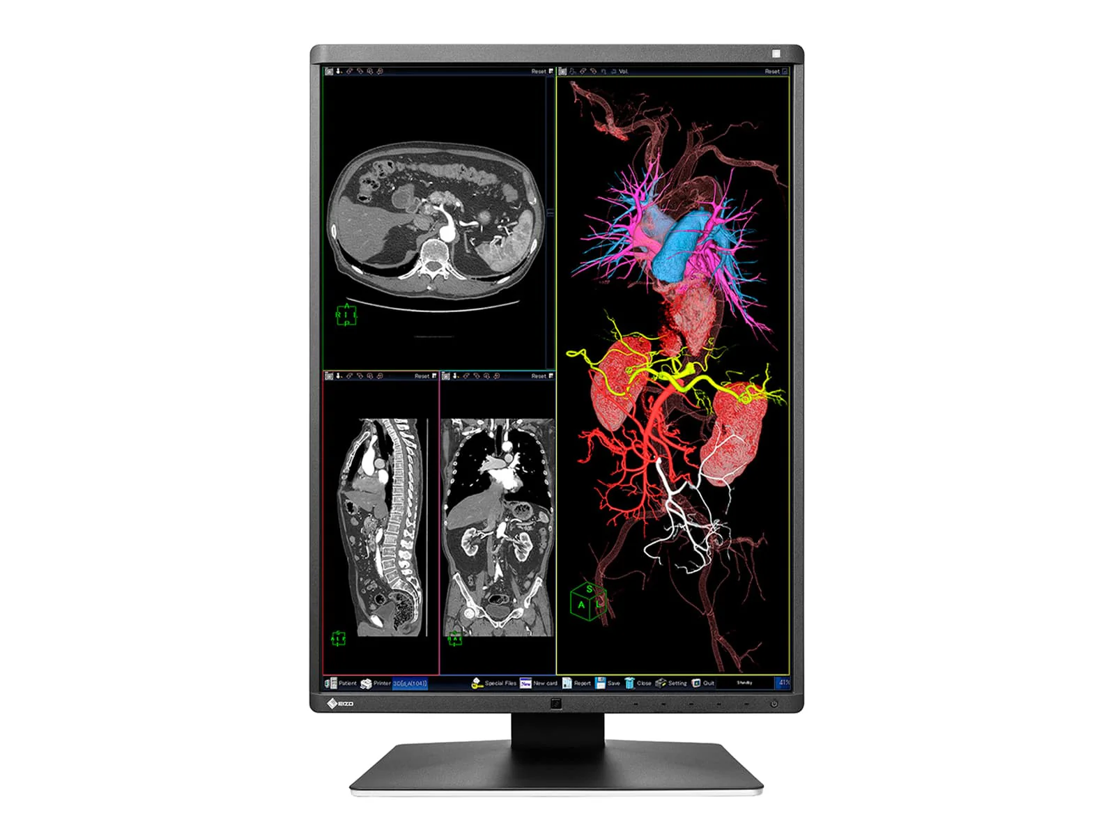 Eizo RadiForce RX360 3MP 21" Color General Radiology PACS Display Monitor (RX360) 4 Eizo RadiForce RX360 3MP 21" Color General Radiology PACS Display Monitor (RX360)