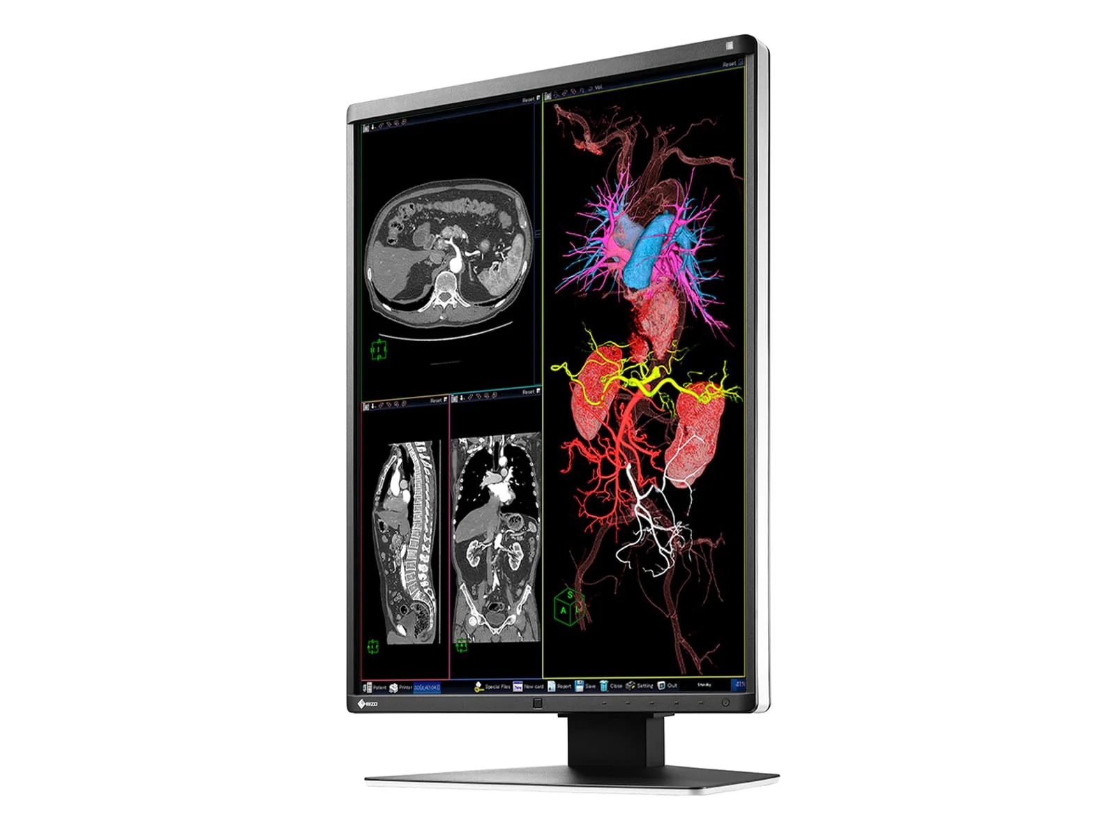Eizo RadiForce RX360 3MP 21" Color General Radiology PACS Display Monitor (RX360) 5 Eizo RadiForce RX360 3MP 21" Color General Radiology PACS Display Monitor (RX360)