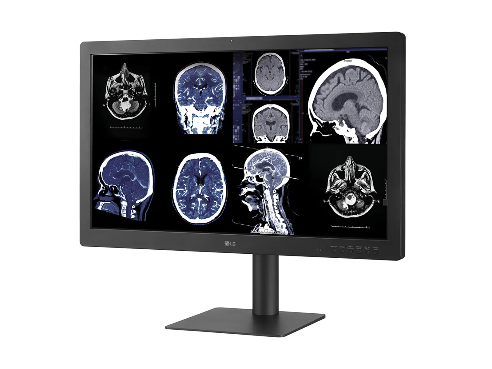 LG 32HQ713D-B 8MP 32" Diagnostic Fusion Color Medical Radiology PACS Monitor - 1000 cd/m² DICOM Brightness 2 LG 32HQ713D-B 8MP 32" Diagnostic Fusion Color Medical Radiology PACS Monitor - 1000 cd/m² DICOM Brightness