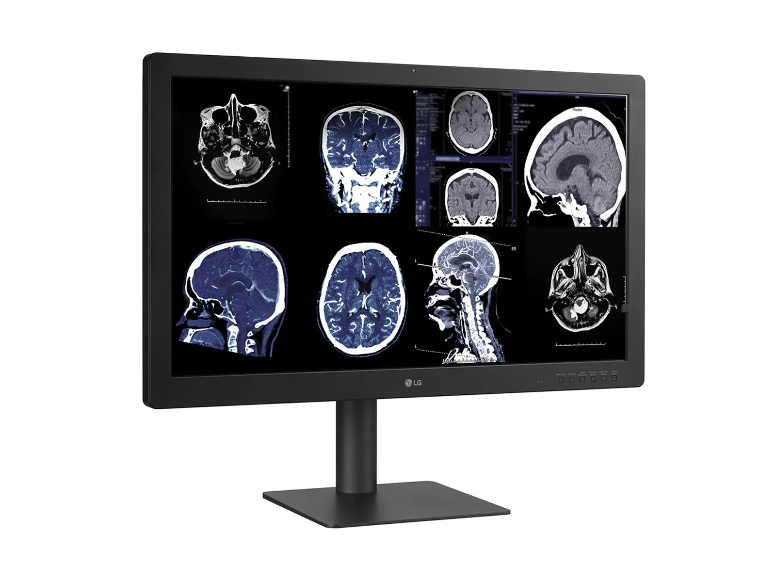 LG 32HQ713D-B 8MP 32" Diagnostic Fusion Color Medical Radiology PACS Monitor - 1000 cd/m² DICOM Brightness 9 LG 32HQ713D-B 8MP 32" Diagnostic Fusion Color Medical Radiology PACS Monitor - 1000 cd/m² DICOM Brightness