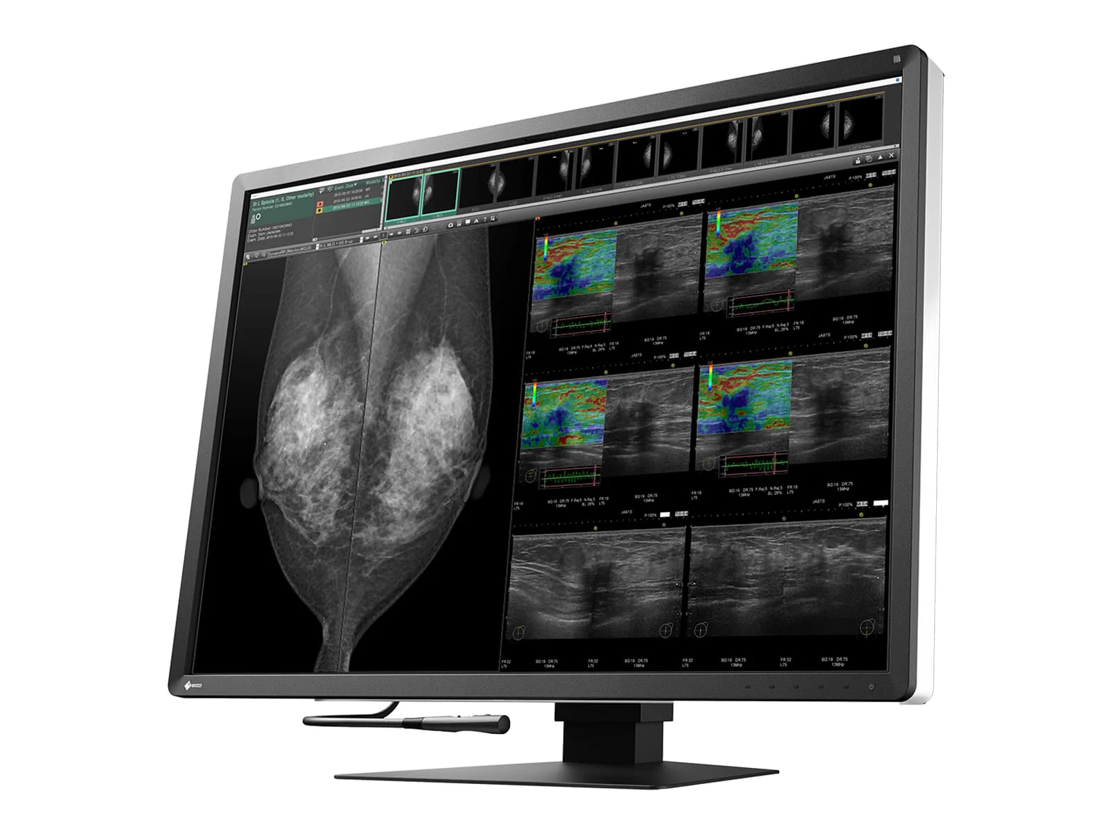 Eizo Radiforce RX1270 12MP 31" Tomo Color Mammo 3D DBT PACS Display (RX1270) 2 Eizo Radiforce RX1270 12MP 31" Tomo Color Mammo 3D DBT PACS Display (RX1270)