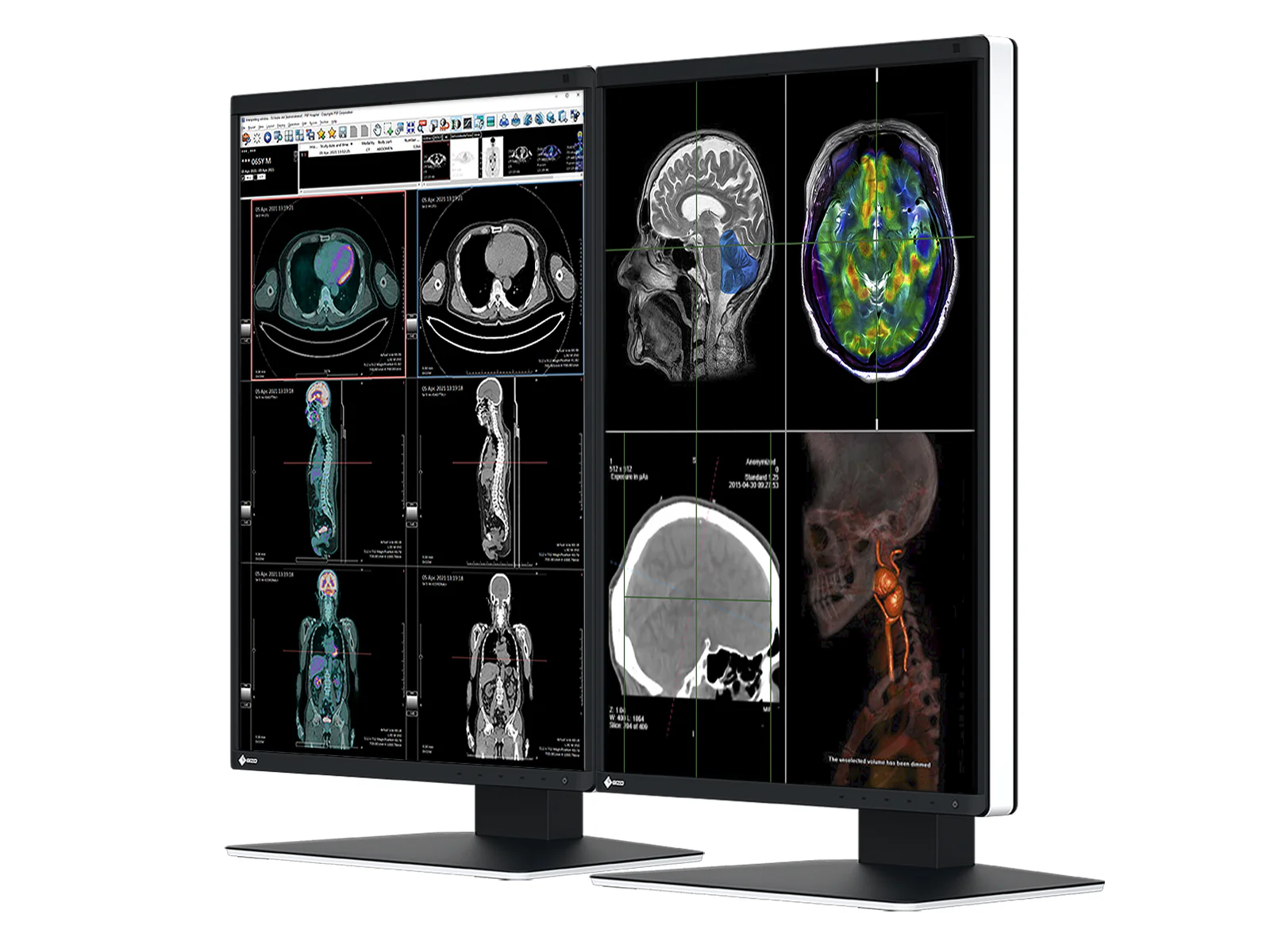 Eizo RadiForce RX370 3MP 21" Color General Radiology Diagnostic PACS Display (RX370) 2 Eizo RadiForce RX370 3MP 21" Color General Radiology Diagnostic PACS Display (RX370)