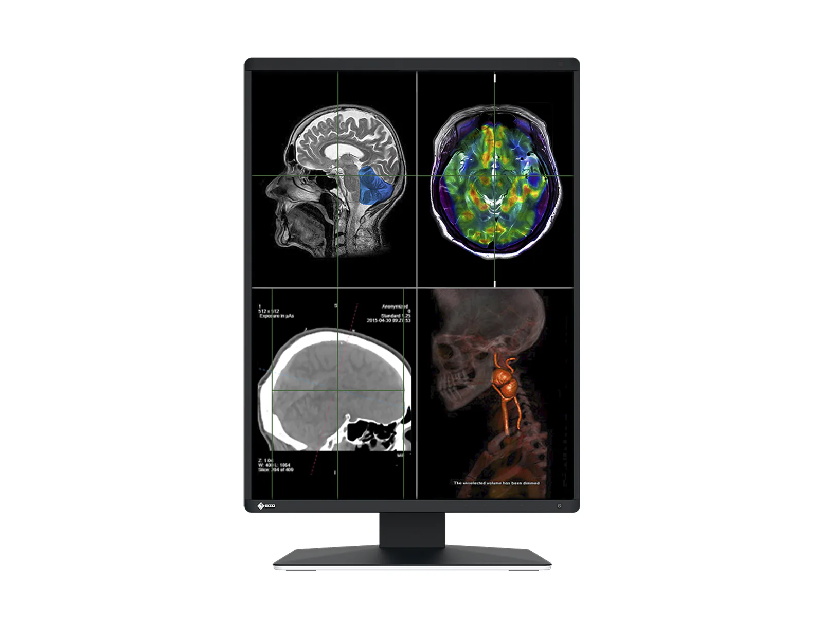 Eizo RadiForce RX370 3MP 21" Color General Radiology Diagnostic PACS Display (RX370) 3 Eizo RadiForce RX370 3MP 21" Color General Radiology Diagnostic PACS Display (RX370)