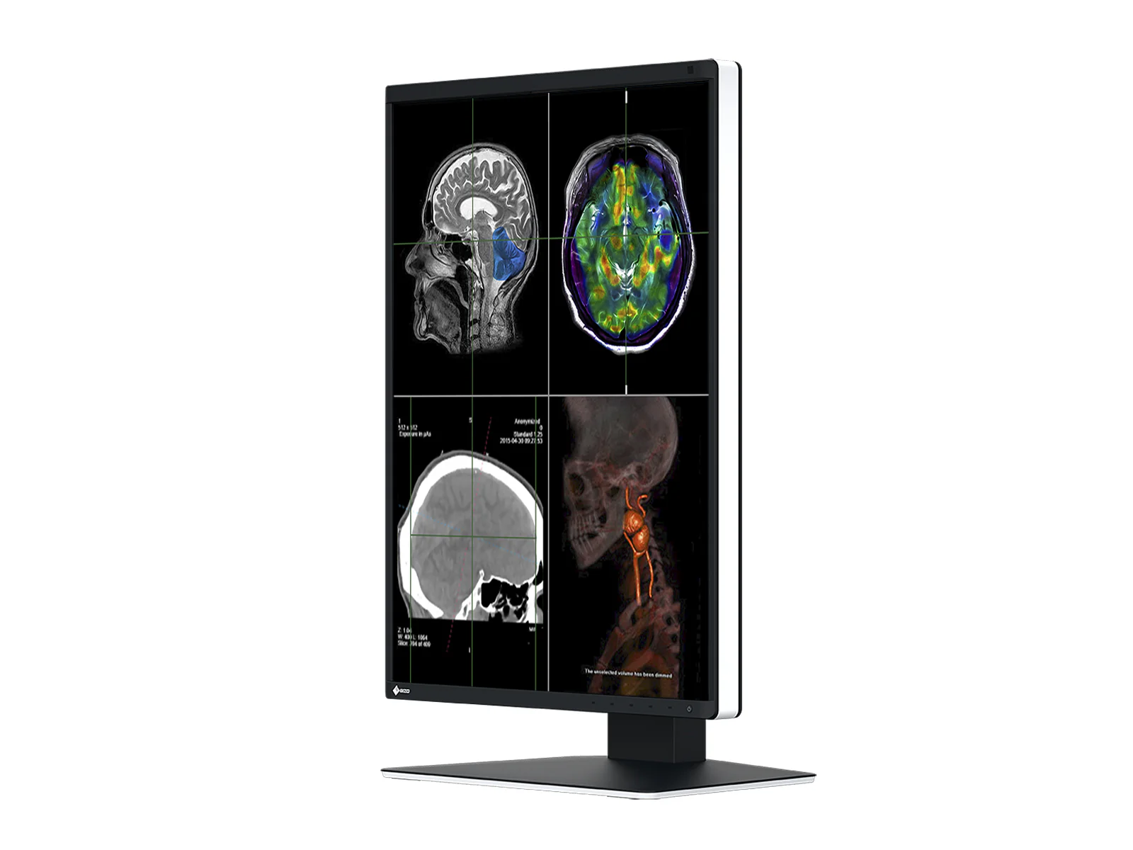 Eizo RadiForce RX370 3MP 21" Color General Radiology Diagnostic PACS Display (RX370) 4 Eizo RadiForce RX370 3MP 21" Color General Radiology Diagnostic PACS Display (RX370)