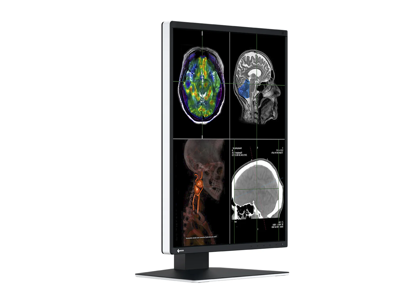 Eizo RadiForce RX370 3MP 21" Color General Radiology Diagnostic PACS Display (RX370) 5 Eizo RadiForce RX370 3MP 21" Color General Radiology Diagnostic PACS Display (RX370)