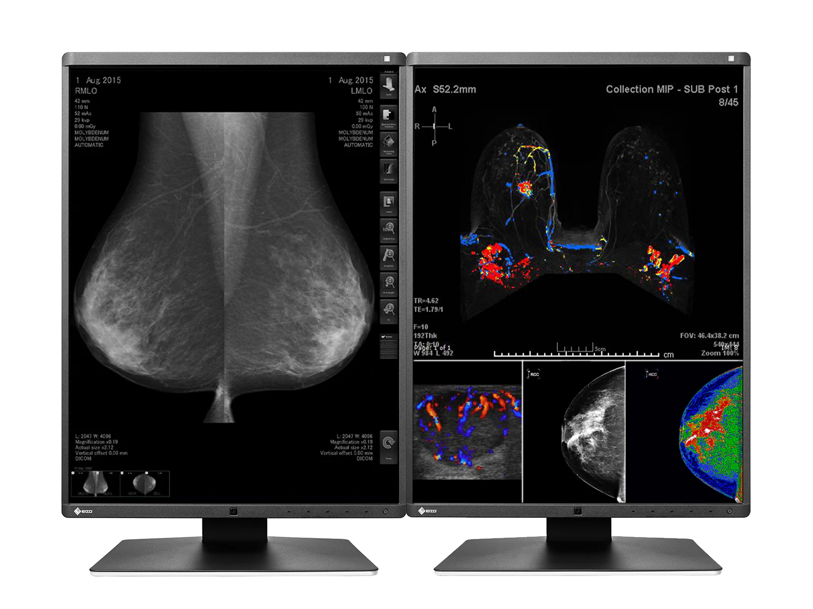 Eizo RadiForce RX560 5MP 21" Color Mammo 3D-DBT Breast Imaging Display (RX560-BK) 2 Eizo RadiForce RX560 5MP 21" Color Mammo 3D-DBT Breast Imaging Display (RX560-BK)