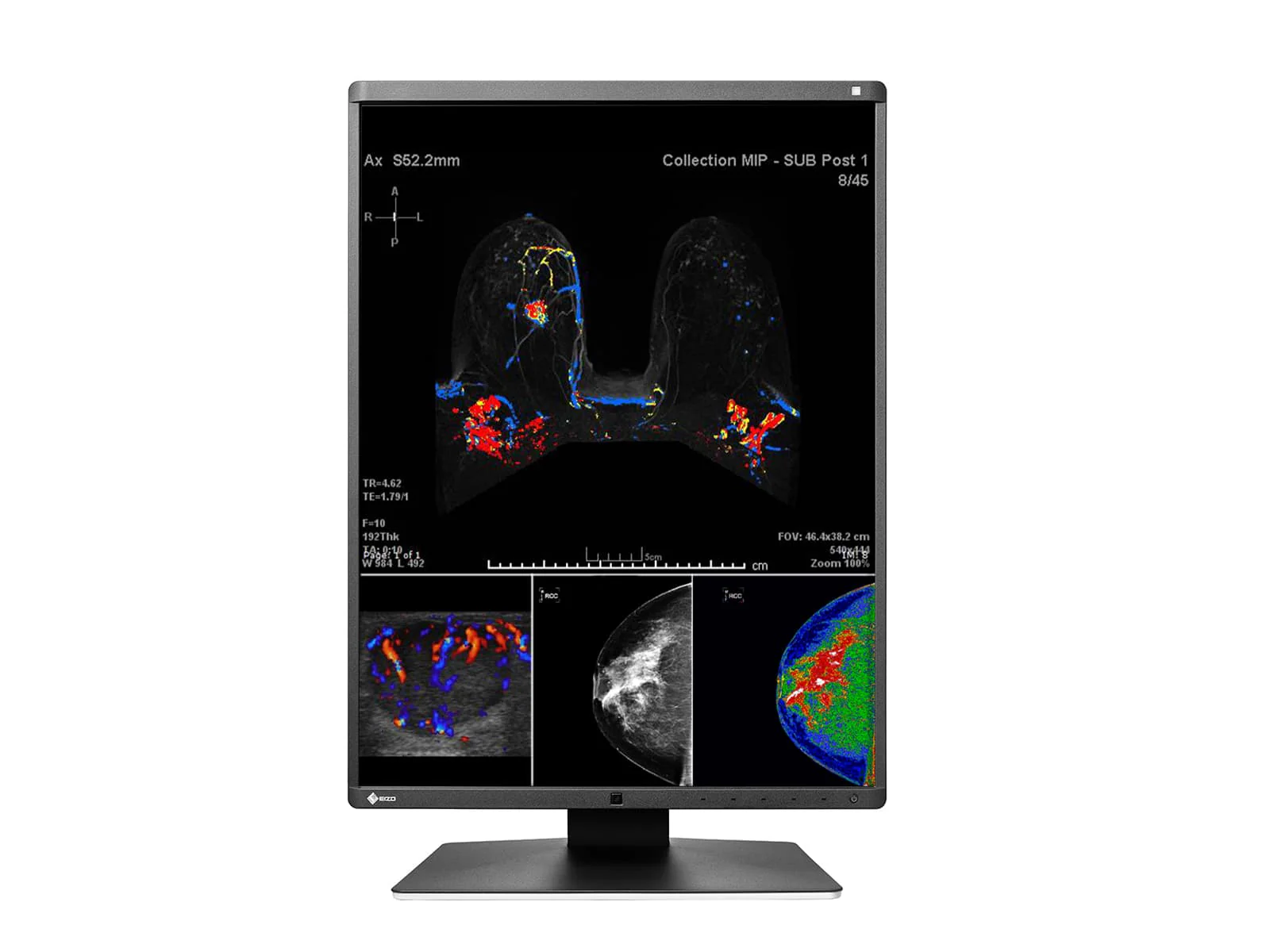 Eizo RadiForce RX560 5MP 21" Color Mammo 3D-DBT Breast Imaging Display (RX560-BK) 3 Eizo RadiForce RX560 5MP 21" Color Mammo 3D-DBT Breast Imaging Display (RX560-BK)