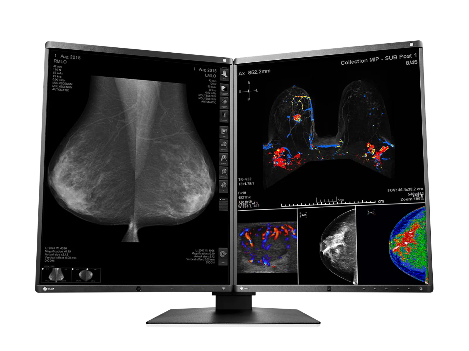 Eizo RadiForce RX560 5MP 21" Color Mammo 3D-DBT Breast Imaging Display (RX560-BK) 4 Eizo RadiForce RX560 5MP 21" Color Mammo 3D-DBT Breast Imaging Display (RX560-BK)