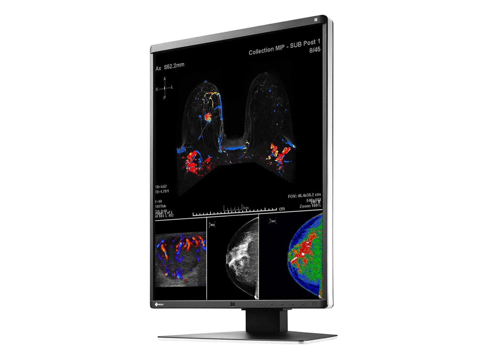 Eizo RadiForce RX560 5MP 21" Color Mammo 3D-DBT Breast Imaging Display (RX560-BK) 5 Eizo RadiForce RX560 5MP 21" Color Mammo 3D-DBT Breast Imaging Display (RX560-BK)