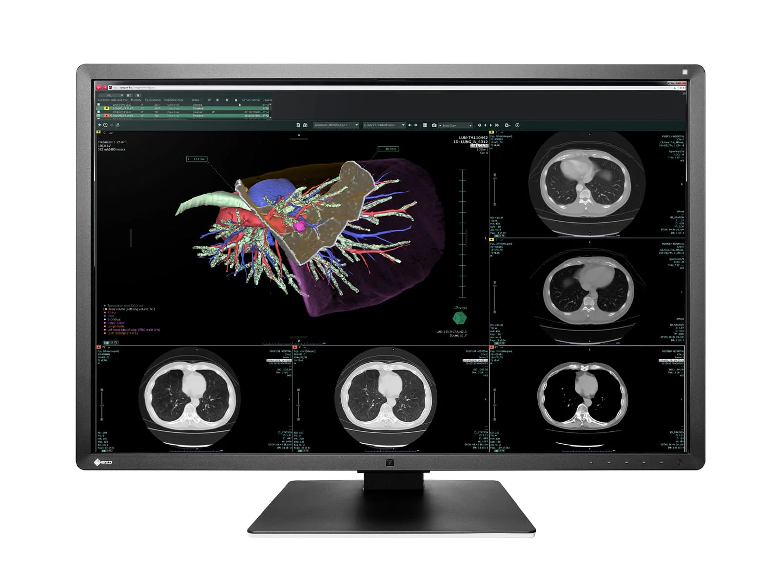 Eizo RadiForce RX660 6MP 30" Color General Radiology PACS Display (RX660-AR)