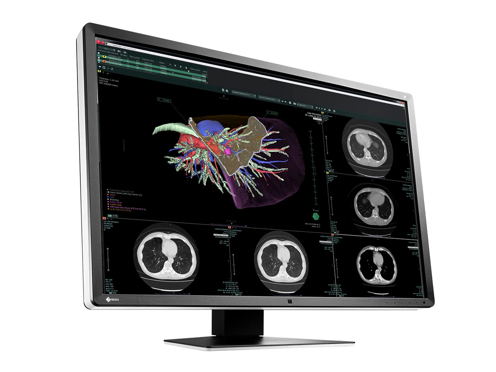 Eizo RadiForce RX660 6MP 30" Color General Radiology PACS Display (RX660-AR) 2 Eizo RadiForce RX660 6MP 30" Color General Radiology PACS Display (RX660-AR)