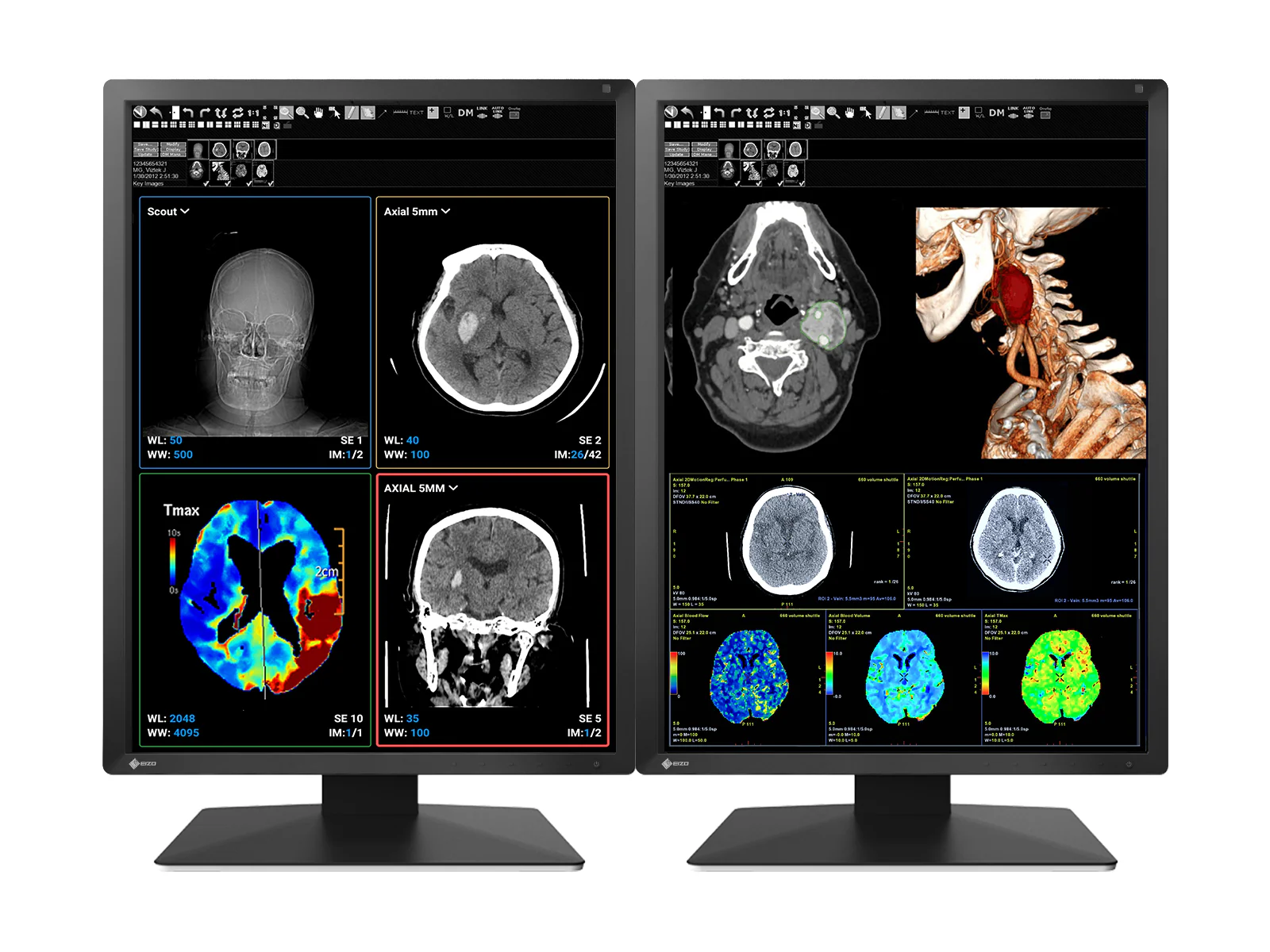 Eizo RadiForce MX217 2MP 21" Color Medical Display Monitor (MX217-BK)