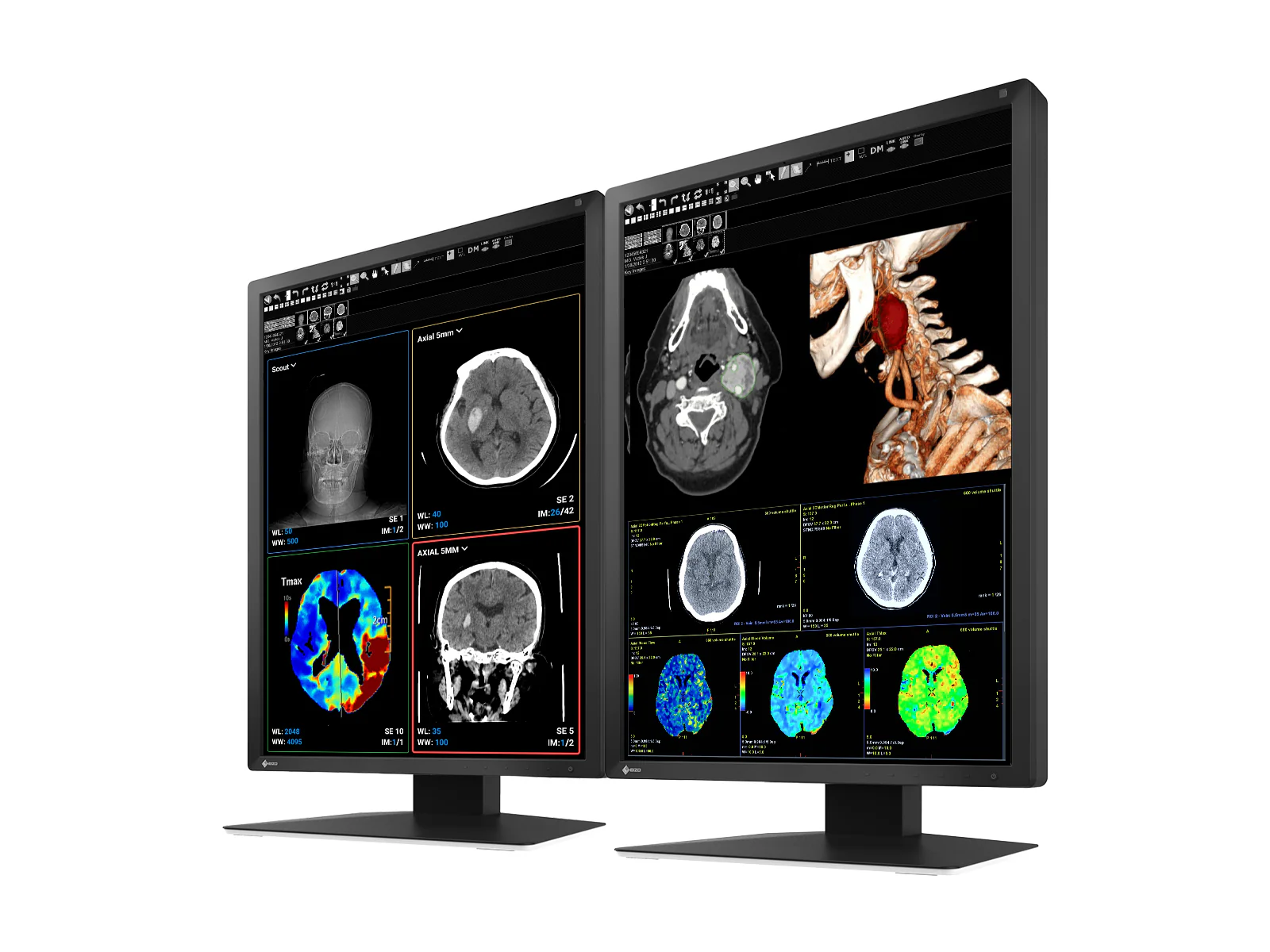 Eizo RadiForce MX217 2MP 21" Color Medical Display Monitor (MX217-BK) 2 Eizo RadiForce MX217 2MP 21" Color Medical Display Monitor (MX217-BK)