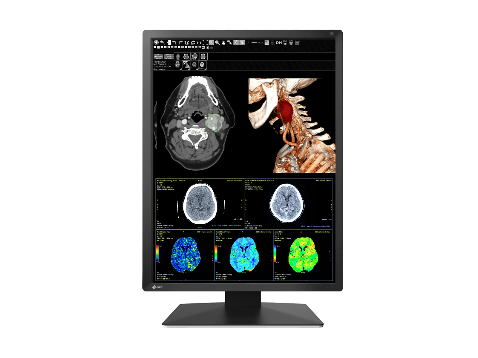 Eizo RadiForce MX217 2MP 21" Color Medical Display Monitor (MX217-BK) 3 Eizo RadiForce MX217 2MP 21" Color Medical Display Monitor (MX217-BK)