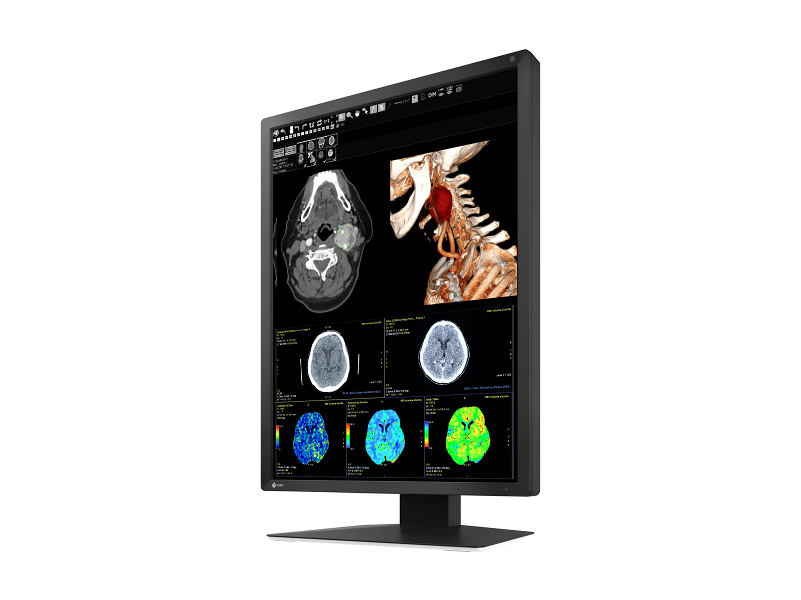 Eizo RadiForce MX217 2MP 21" Color Medical Display Monitor (MX217-BK) 4 Eizo RadiForce MX217 2MP 21" Color Medical Display Monitor (MX217-BK)