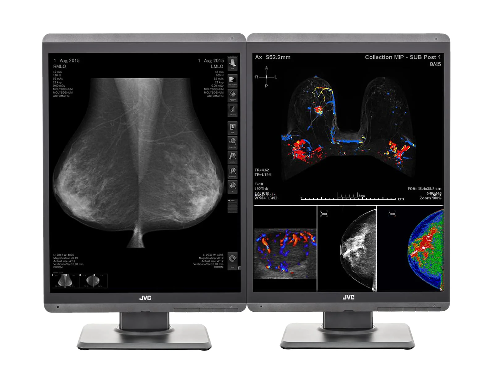 JVC Totoku CL-S500 5MP 21" Color Mammo 3D-DBT Breast Imaging Display (CL-S500) 1 JVC Totoku CL-S500 5MP 21" Color Mammo 3D-DBT Breast Imaging Display (CL-S500)