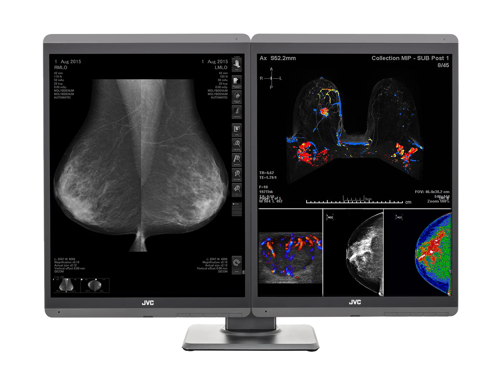JVC Totoku CL-S500 5MP 21" Color Mammo 3D-DBT Breast Imaging Display (CL-S500) 2 JVC Totoku CL-S500 5MP 21" Color Mammo 3D-DBT Breast Imaging Display (CL-S500)
