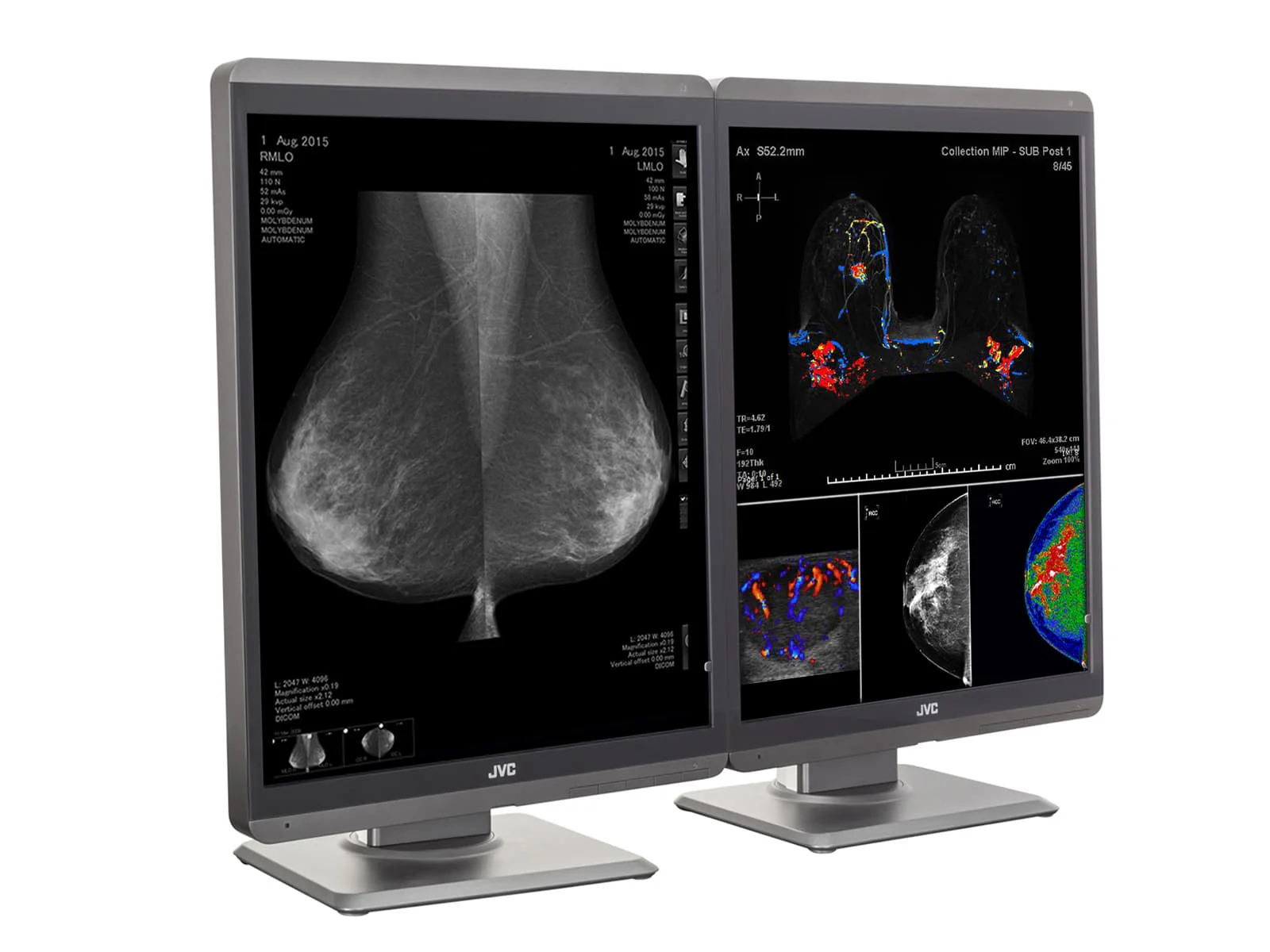 JVC Totoku CL-S500 5MP 21" Color Mammo 3D-DBT Breast Imaging Display (CL-S500) 3 JVC Totoku CL-S500 5MP 21" Color Mammo 3D-DBT Breast Imaging Display (CL-S500)