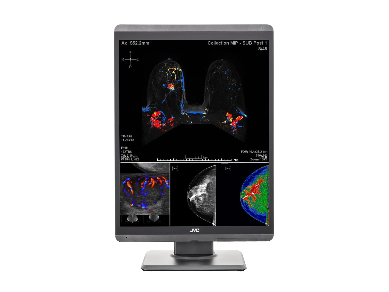 JVC Totoku CL-S500 5MP 21" Color Mammo 3D-DBT Breast Imaging Display (CL-S500) 5 JVC Totoku CL-S500 5MP 21" Color Mammo 3D-DBT Breast Imaging Display (CL-S500)