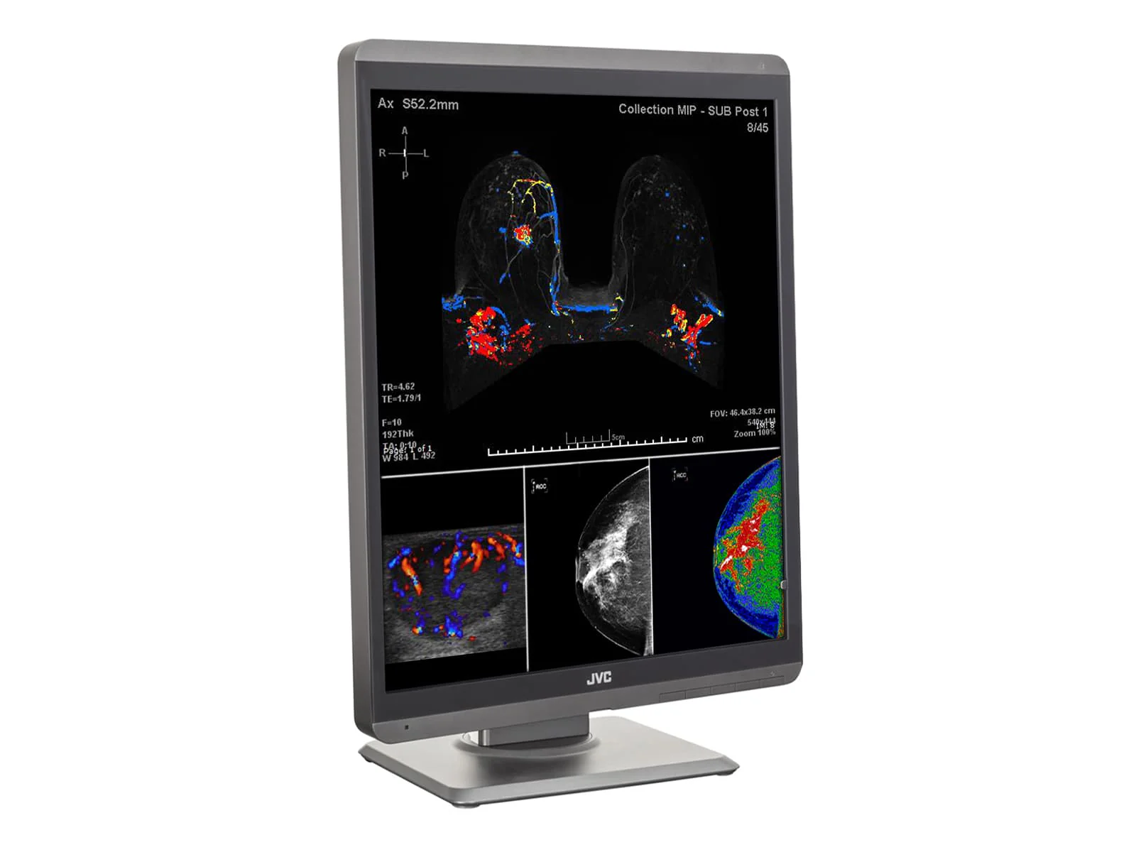 JVC Totoku CL-S500 5MP 21" Color Mammo 3D-DBT Breast Imaging Display (CL-S500) 6 JVC Totoku CL-S500 5MP 21" Color Mammo 3D-DBT Breast Imaging Display (CL-S500)