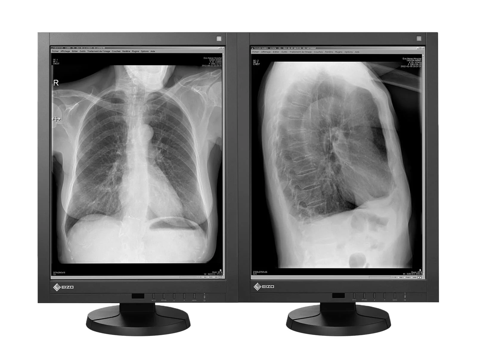 Eizo RadiForce GX340 3MP 21" Grayscale General Radiology Diagnostic Display Monitor (GX340-CL)