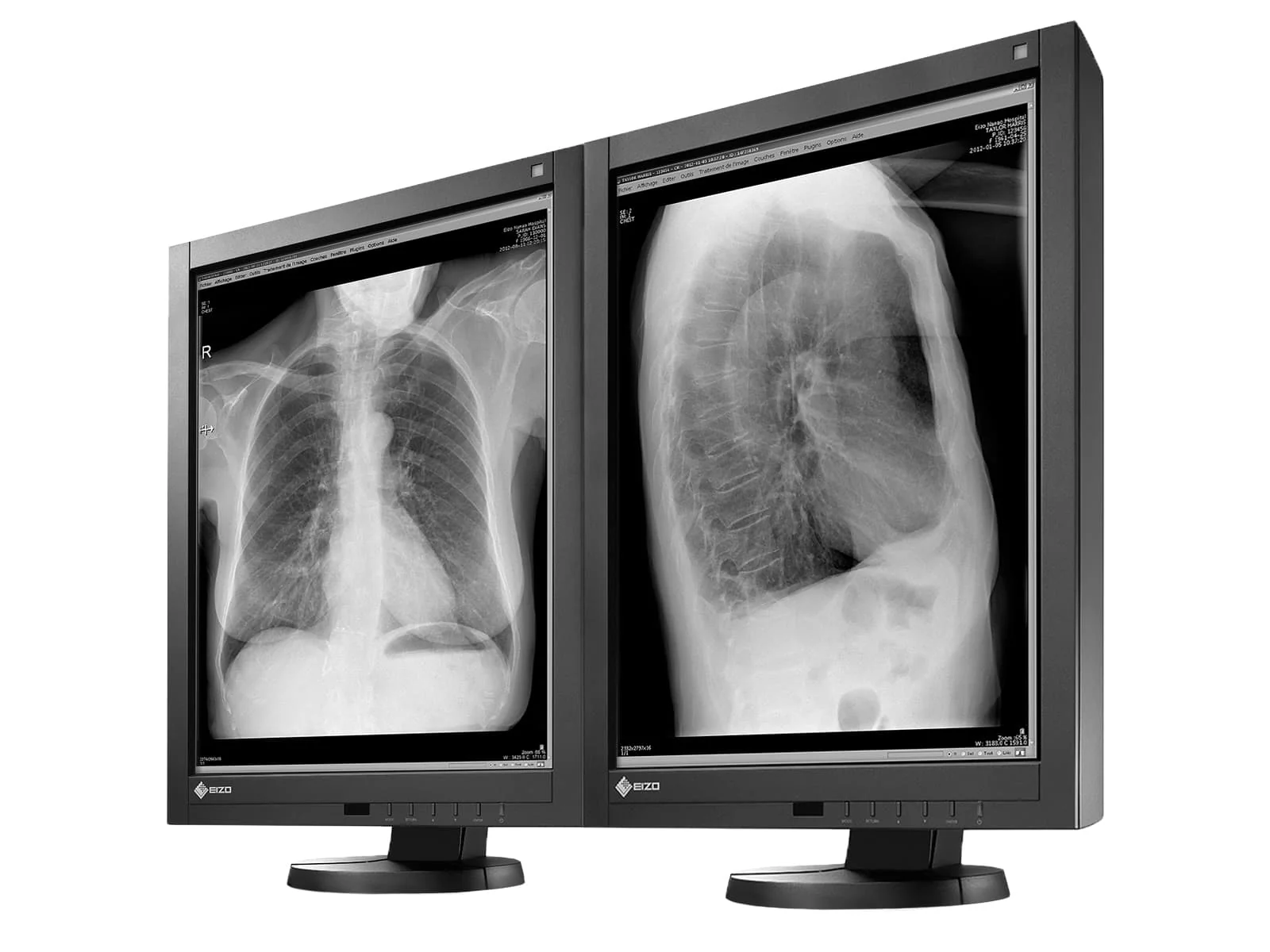 Eizo RadiForce GX340 3MP 21" Grayscale General Radiology Diagnostic Display Monitor (GX340-CL) 2 Eizo RadiForce GX340 3MP 21" Grayscale General Radiology Diagnostic Display Monitor (GX340-CL)