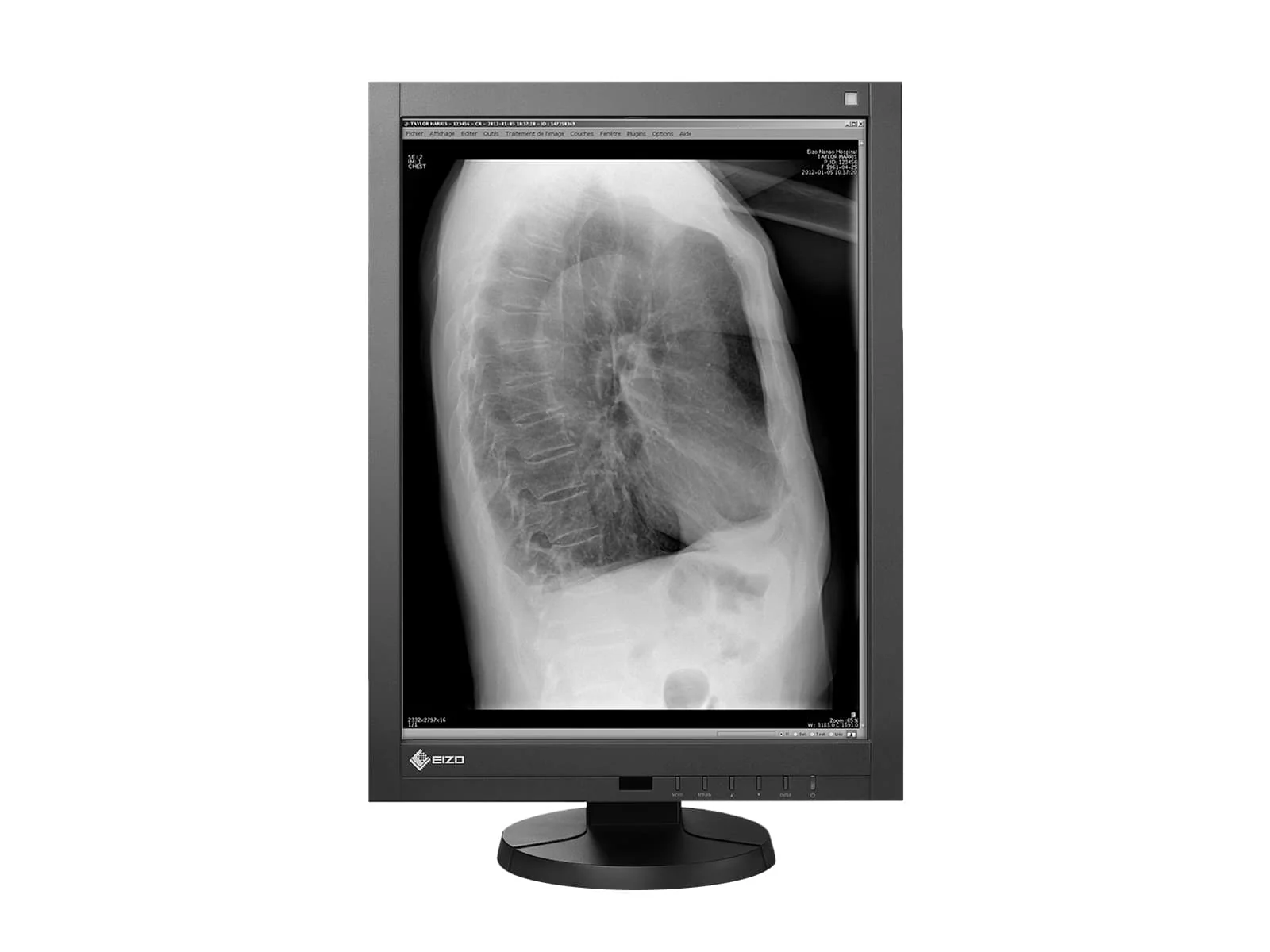 Eizo RadiForce GX340 3MP 21" Grayscale General Radiology Diagnostic Display Monitor (GX340-CL) 3 Eizo RadiForce GX340 3MP 21" Grayscale General Radiology Diagnostic Display Monitor (GX340-CL)