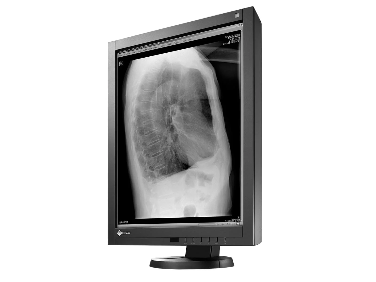 Eizo RadiForce GX340 3MP 21" Grayscale General Radiology Diagnostic Display Monitor (GX340-CL) 4 Eizo RadiForce GX340 3MP 21" Grayscale General Radiology Diagnostic Display Monitor (GX340-CL)