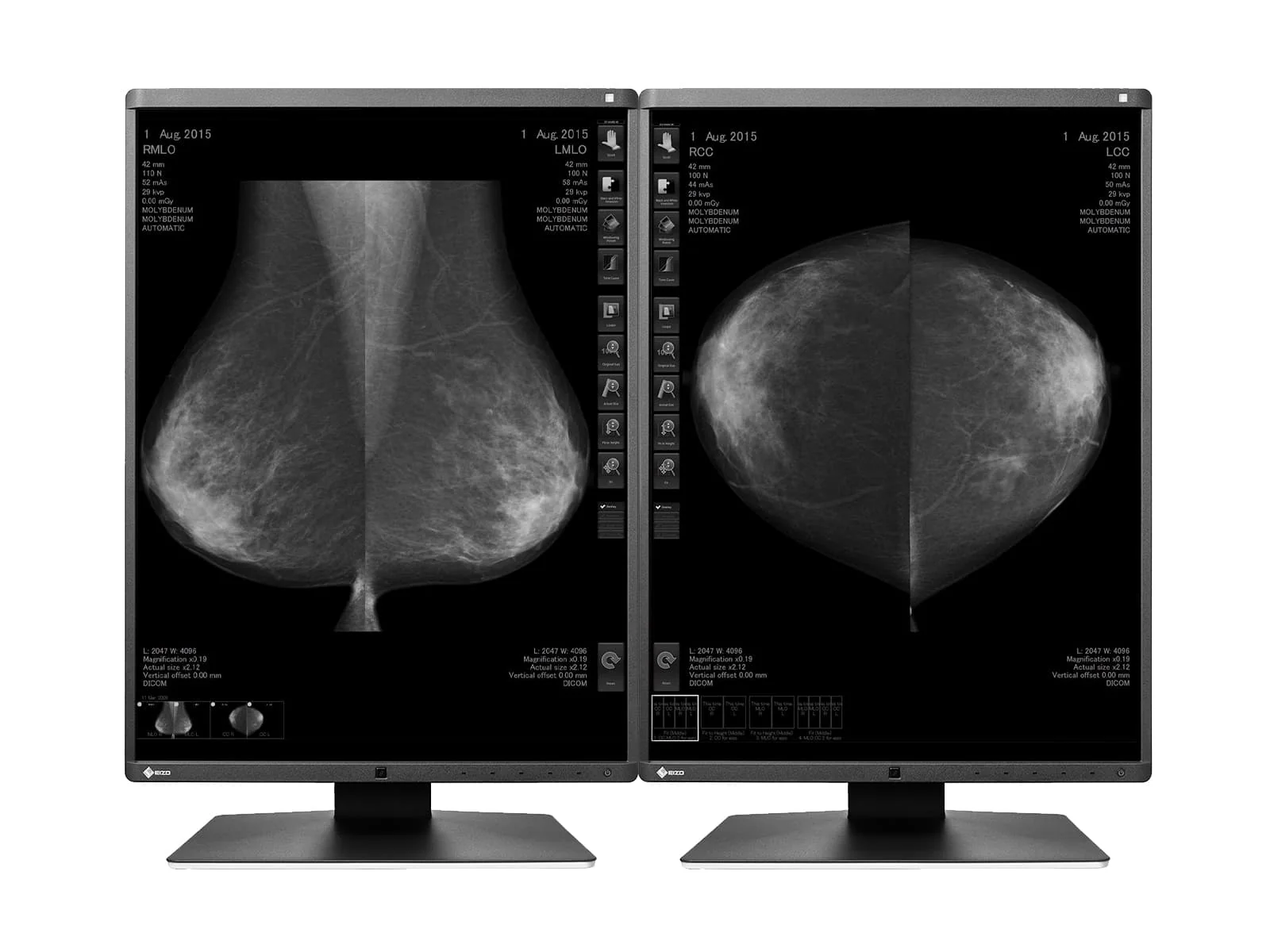 Eizo RadiForce GX560 5MP 21" Grayscale Mammo 3D-DBT Breast Imaging Display Monitor (GX560-MD)