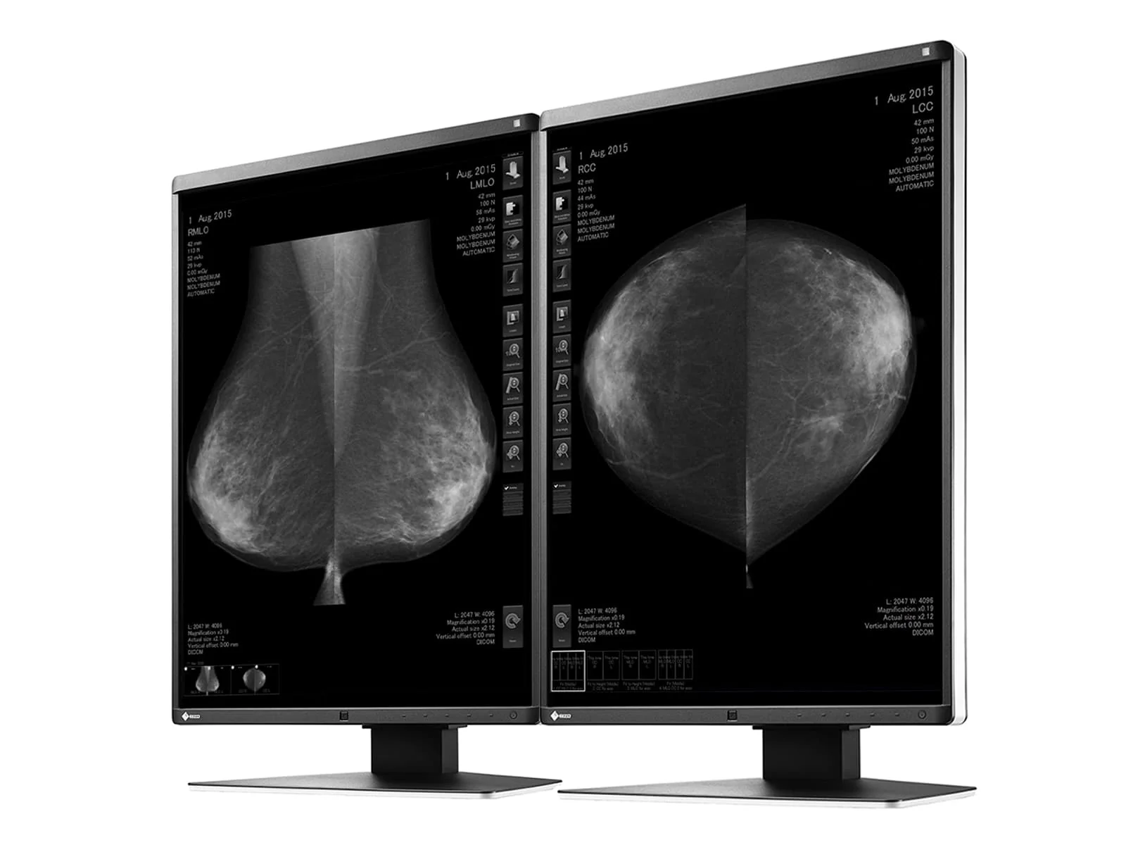 Eizo RadiForce GX560 5MP 21" Grayscale Mammo 3D-DBT Breast Imaging Display Monitor (GX560-MD) 2 Eizo RadiForce GX560 5MP 21" Grayscale Mammo 3D-DBT Breast Imaging Display Monitor (GX560-MD)