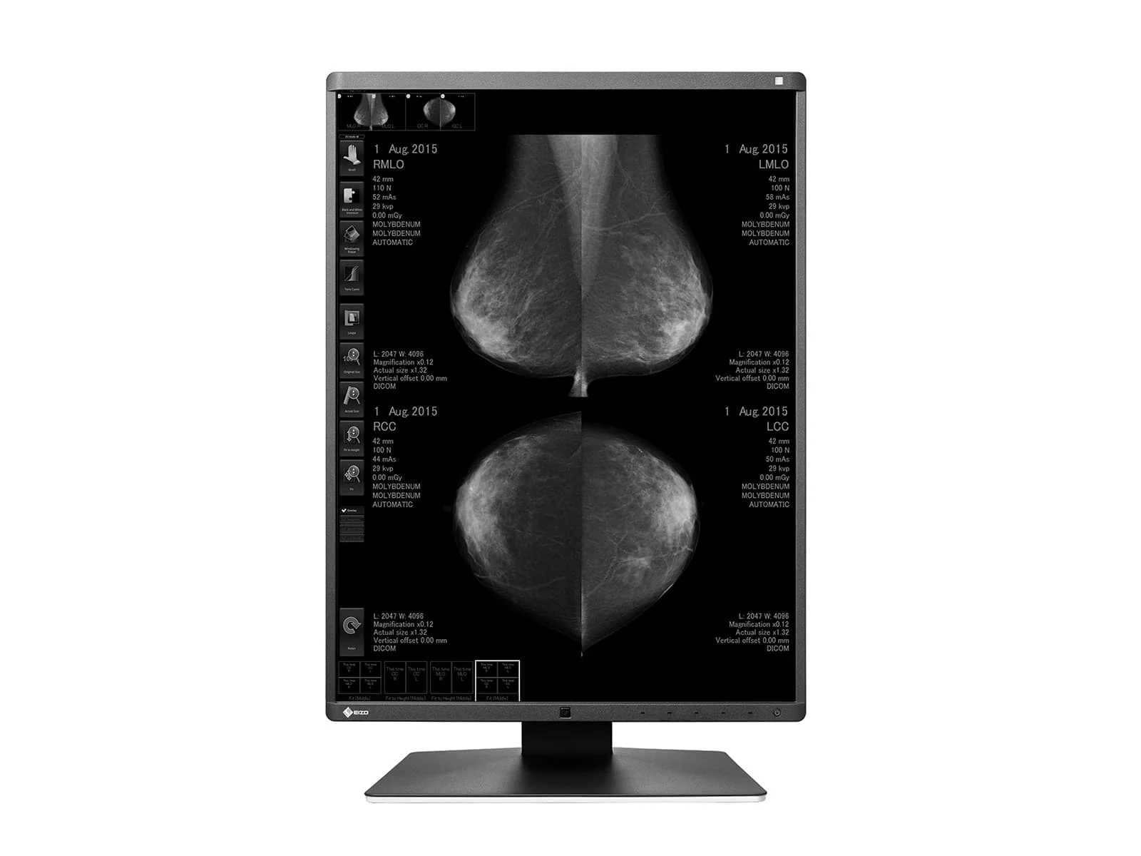 Eizo RadiForce GX560 5MP 21" Grayscale Mammo 3D-DBT Breast Imaging Display Monitor (GX560-MD) 4 Eizo RadiForce GX560 5MP 21" Grayscale Mammo 3D-DBT Breast Imaging Display Monitor (GX560-MD)