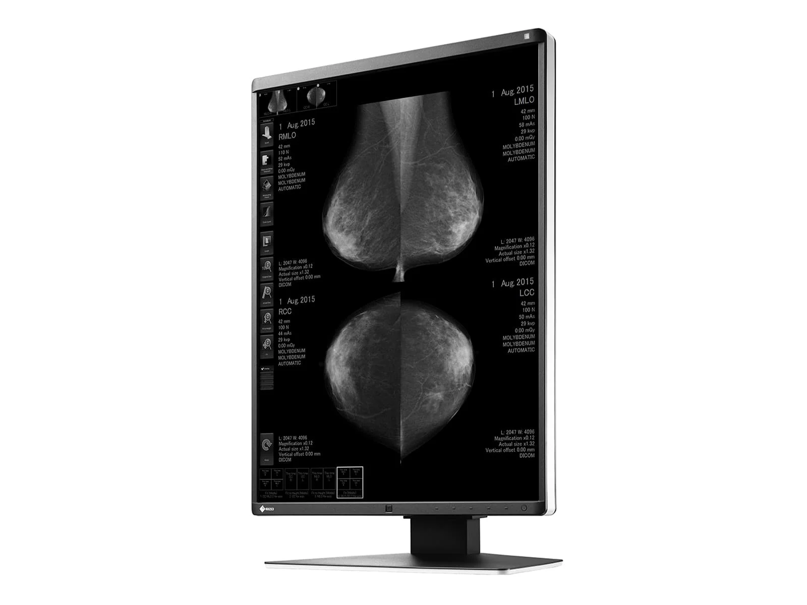 Eizo RadiForce GX560 5MP 21" Grayscale Mammo 3D-DBT Breast Imaging Display Monitor (GX560-MD) 5 Eizo RadiForce GX560 5MP 21" Grayscale Mammo 3D-DBT Breast Imaging Display Monitor (GX560-MD)
