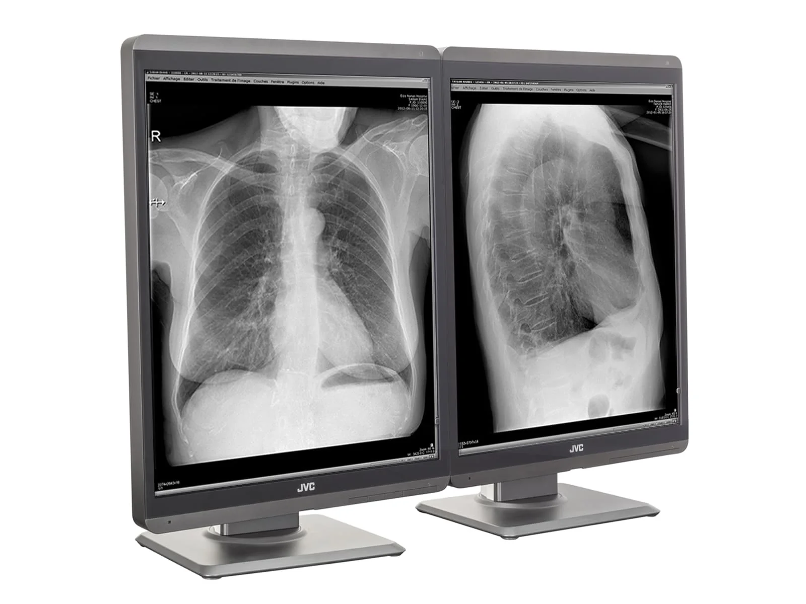 JVC Totoku MS-S300 3MP 21" Grayscale General Radiology Diagnostic Display Monitor (MS-S300) 2 JVC Totoku MS-S300 3MP 21" Grayscale General Radiology Diagnostic Display Monitor (MS-S300)