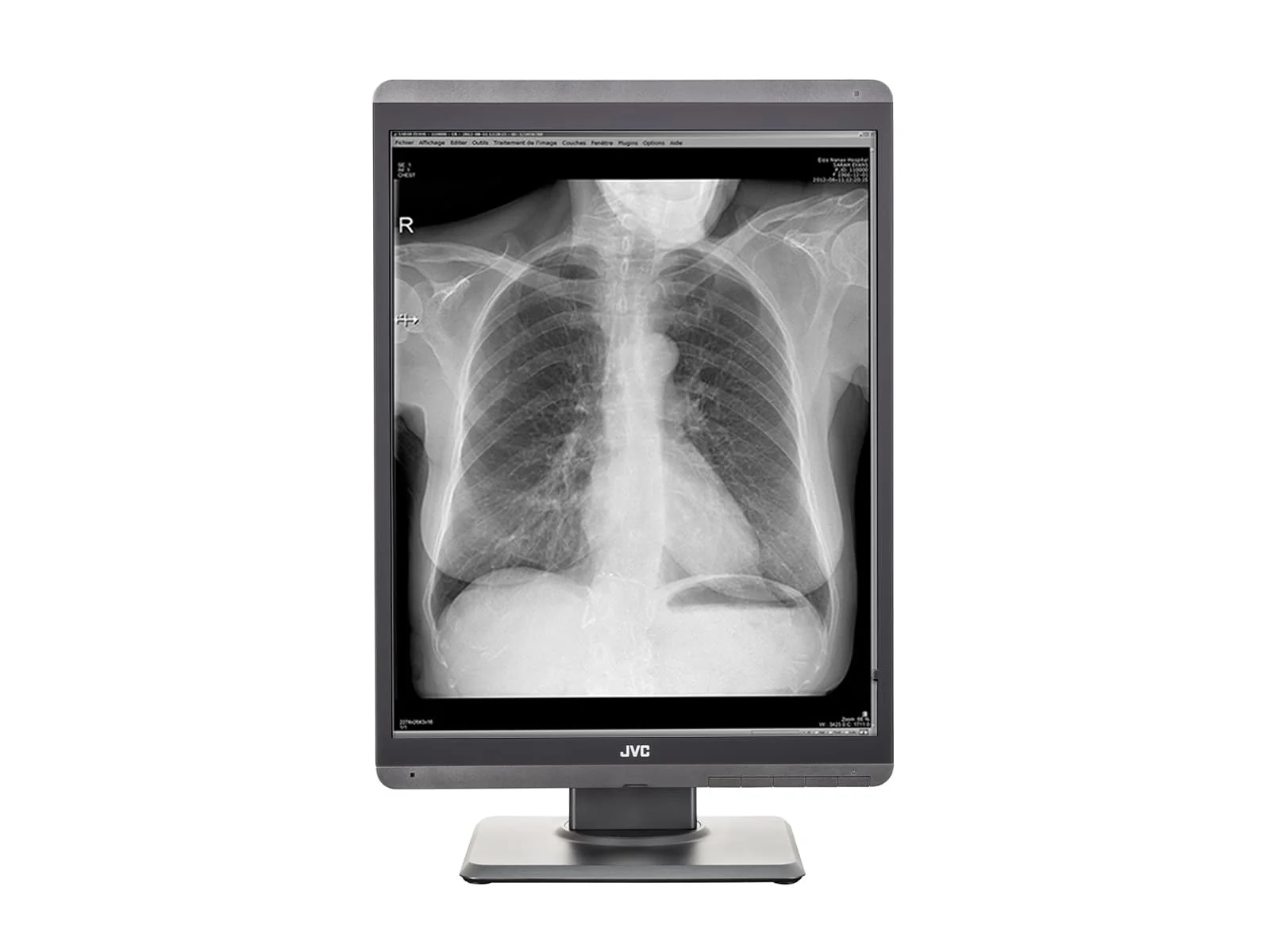 JVC Totoku MS-S300 3MP 21" Grayscale General Radiology Diagnostic Display Monitor (MS-S300) 4 JVC Totoku MS-S300 3MP 21" Grayscale General Radiology Diagnostic Display Monitor (MS-S300)