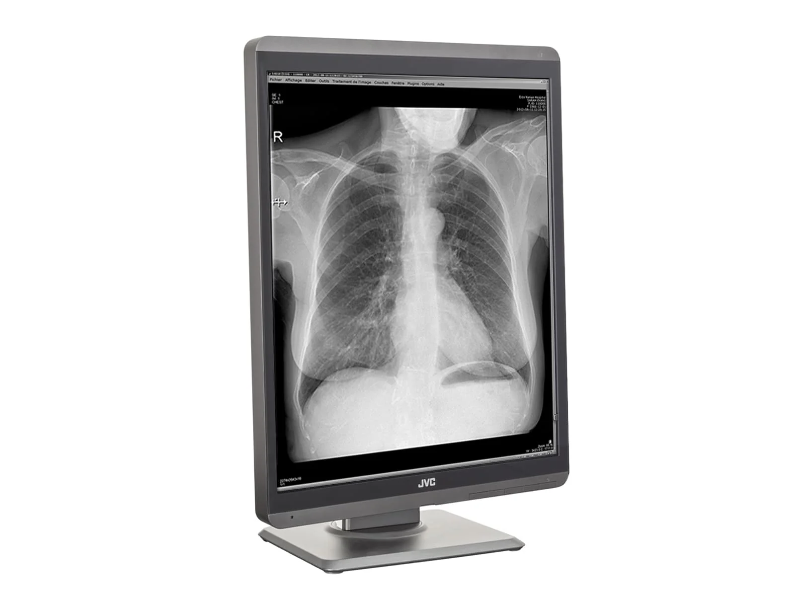 JVC Totoku MS-S300 3MP 21" Grayscale General Radiology Diagnostic Display Monitor (MS-S300) 5 JVC Totoku MS-S300 3MP 21" Grayscale General Radiology Diagnostic Display Monitor (MS-S300)