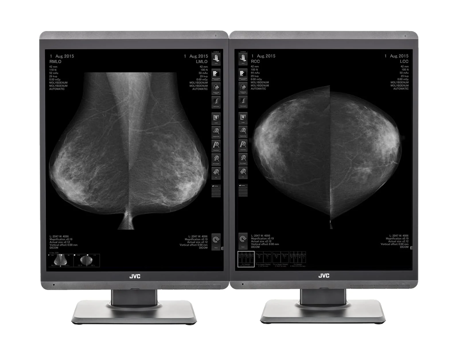 JVC Totoku MS-S500 5MP 21" Mammo 3D-DBT Grayscale Breast Imaging Display (MS-S500) 1 JVC Totoku MS-S500 5MP 21" Mammo 3D-DBT Grayscale Breast Imaging Display (MS-S500)